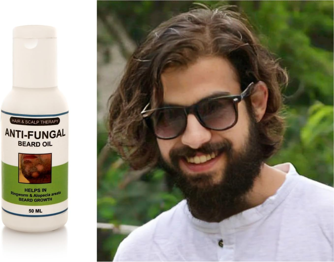 Sun'S Heart Anti-Fungal Beard Oil (Helps in Ringworm, Alopecia Areata) 50Ml