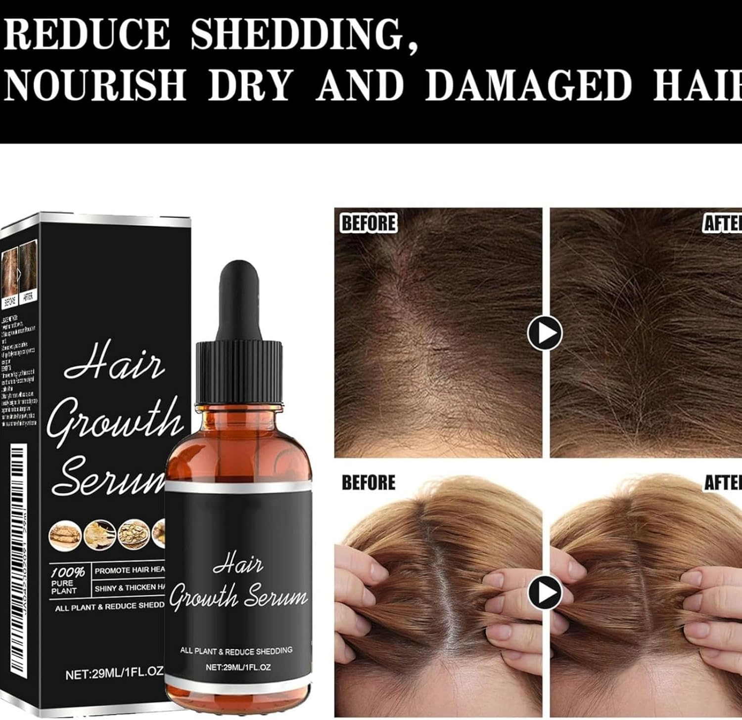 Lifewitqueenp Hair Care Growth Oil, Natural Hairs Quick Absorption Growth Density Essential Oil, Nourishes Hair, Reduces Breakage, Strengthens Hair Roots, Keeps Hair Smooth and Soft (3PCS) - 2Pcs image number 4