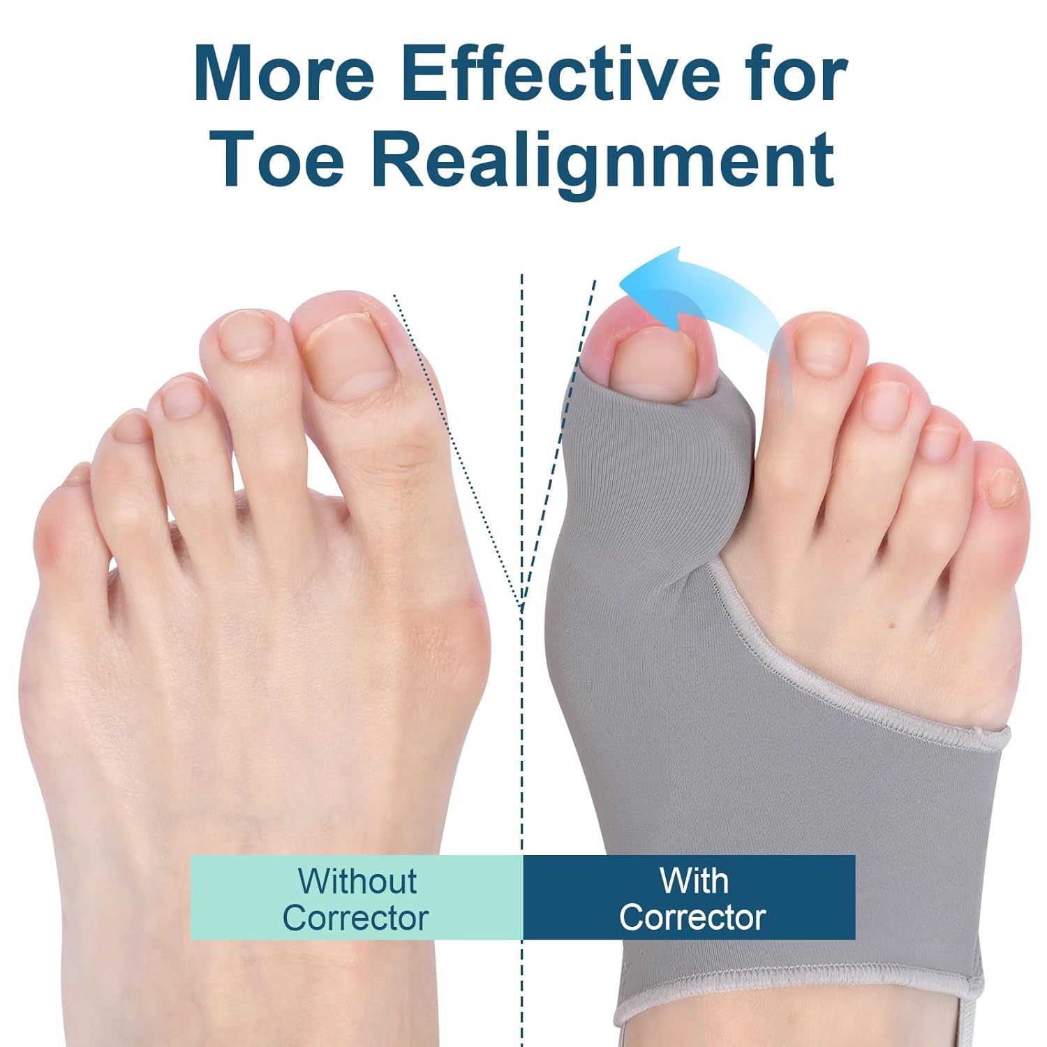 Bunion Corrector for Women Big Toe, Bunion Corrector for Men Hallux Valgus Pain Relief, Big Toe Separator, Comfortable, Breathable & Non-Slip Hammer Toe Straightener, Day/Night Support（2Pcs ） image number 4