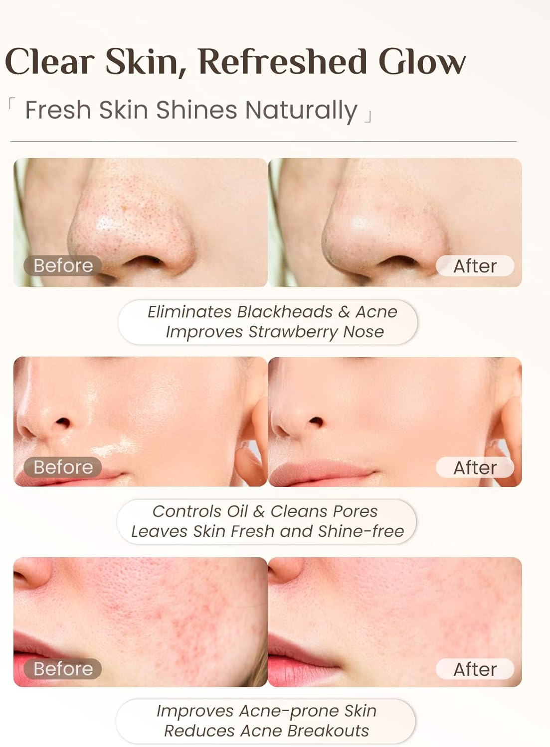 Rena Chris Silicone Face Scrubber, 3 in 1 Face Mask Applicator & Pore Cleaning Brush, 3 Pack Double-End Facial Cleansing Brush for Exfoliating, Blackhead Removal, Skincare Applicator for Mud image number 1