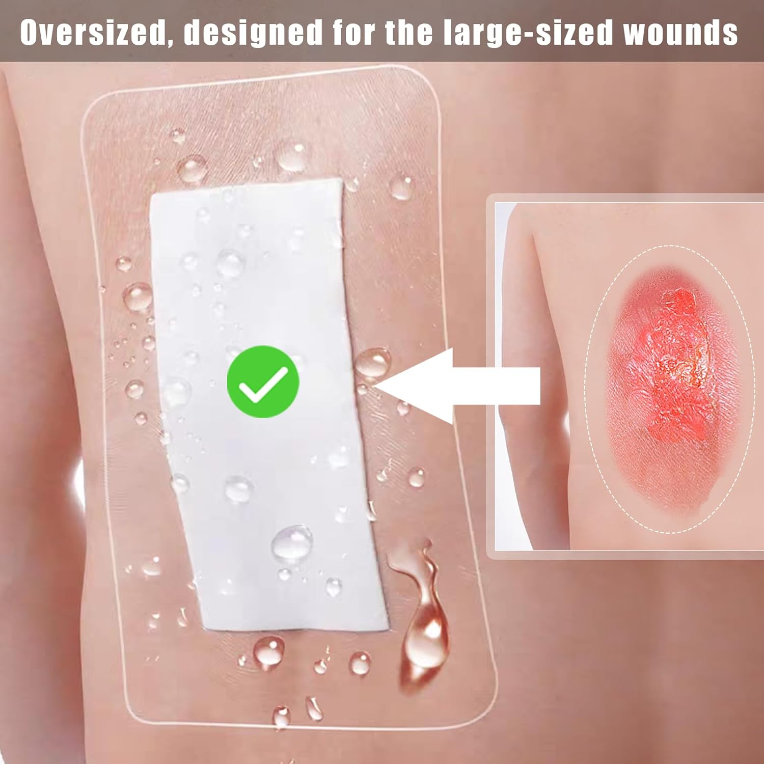 Large Wound Dressings, Adhesive Waterproof Dressing Pad Bandage Patches for Post Surgical Shower Wound Cover,6Pcs image number 2