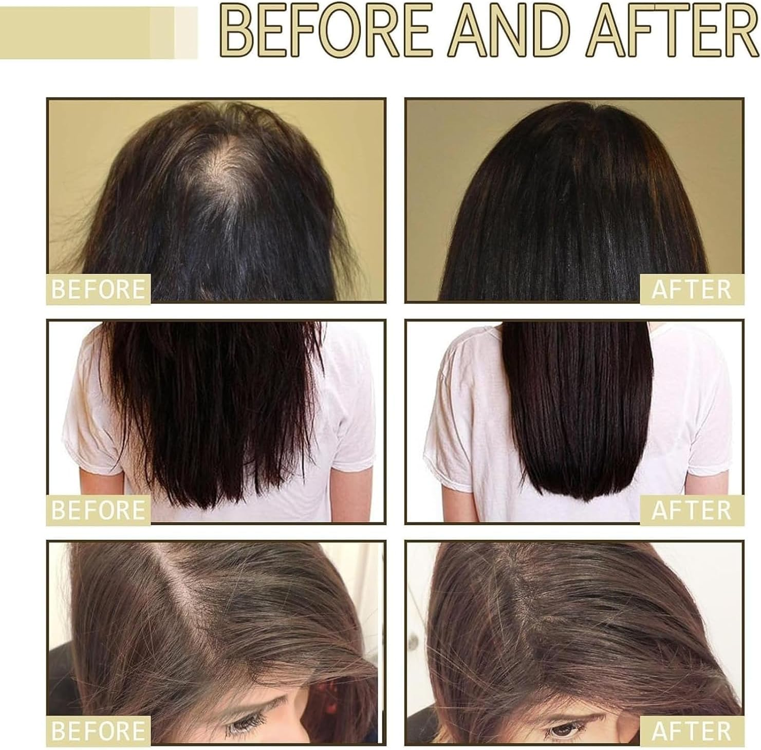 2PCS Veganic Natural Hair Growth Oil,Natural Hair Growth Oil,Natural Hair Density Essential Oil,Rosemary Hair Growth Oil for Dry Damaged Hair and Growth Thin Hair image number 3