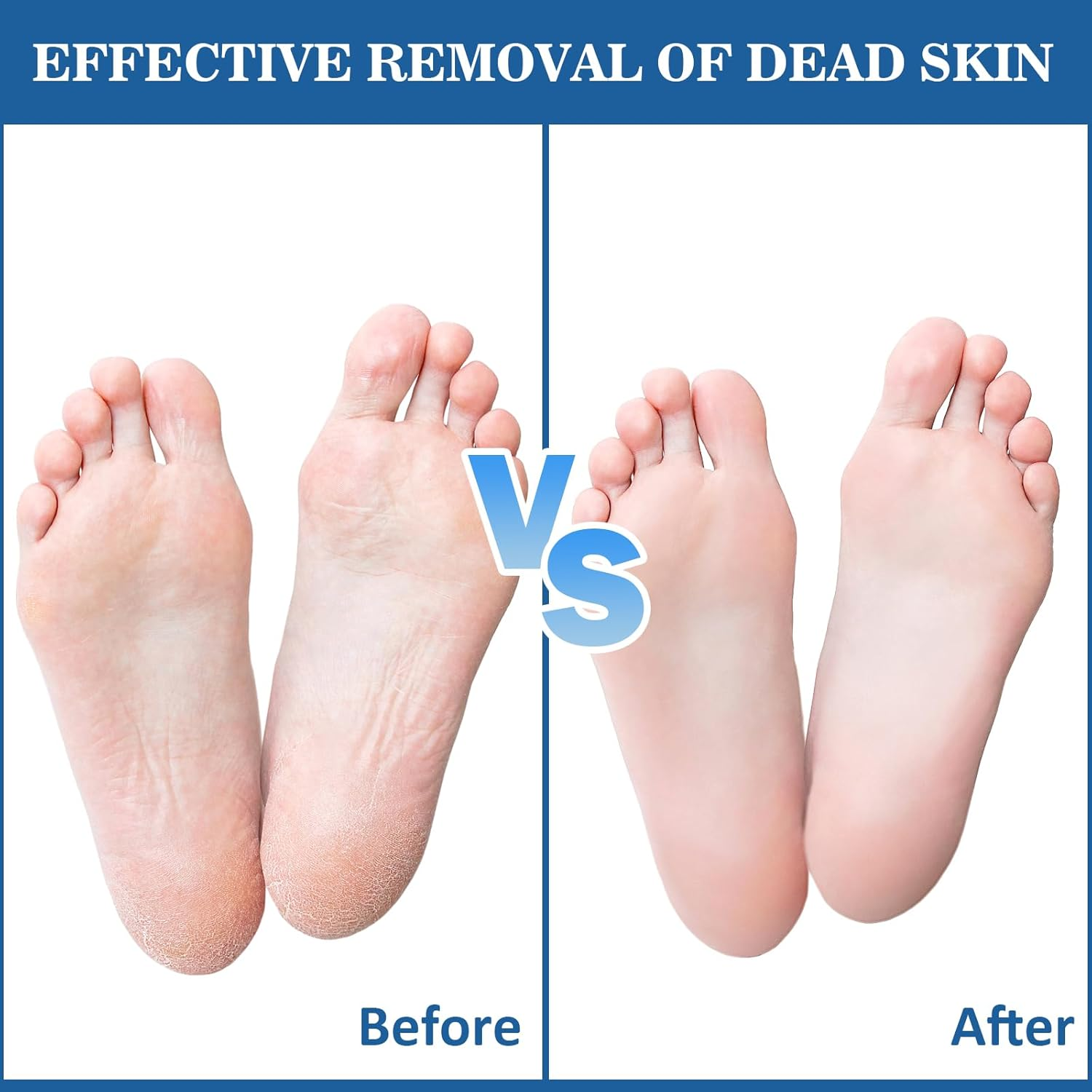 VEGCOO Pedicure Files Refill Pads Callus Remover, Pack of 55 Pedicure Files Refill Set for Removing Dead Skin, Shower and Pedicure (Large 100) image number 6