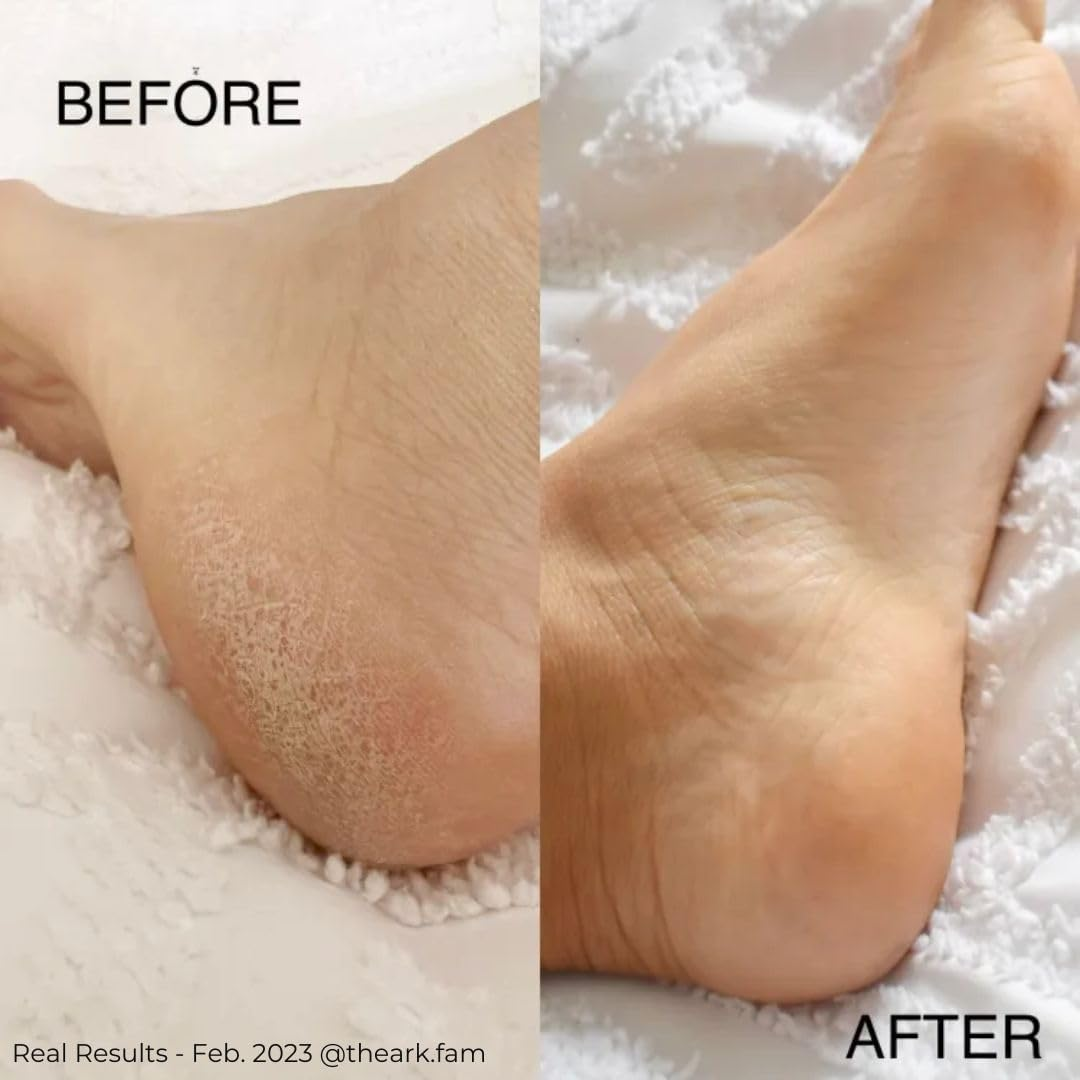 Plunkett'S NS8 Heel Balm Complex 75G