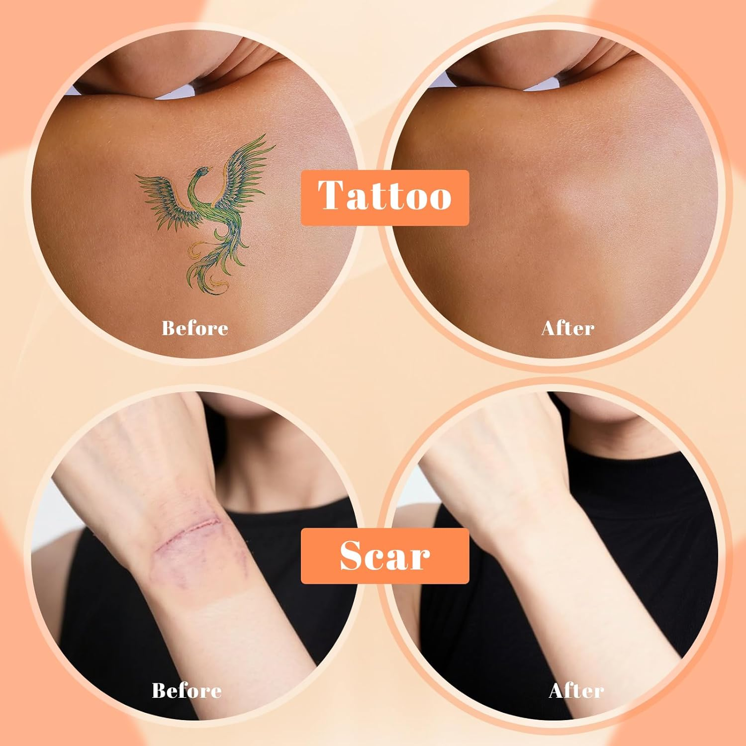 DAGEDA 2 Colors Tattoo Cover up Makeup, Long-Lasting Face Body Concealer, Invisible, Natural, Waterproof Tattoo Cover Makeup with Concealer Brush(04+05) image number 6