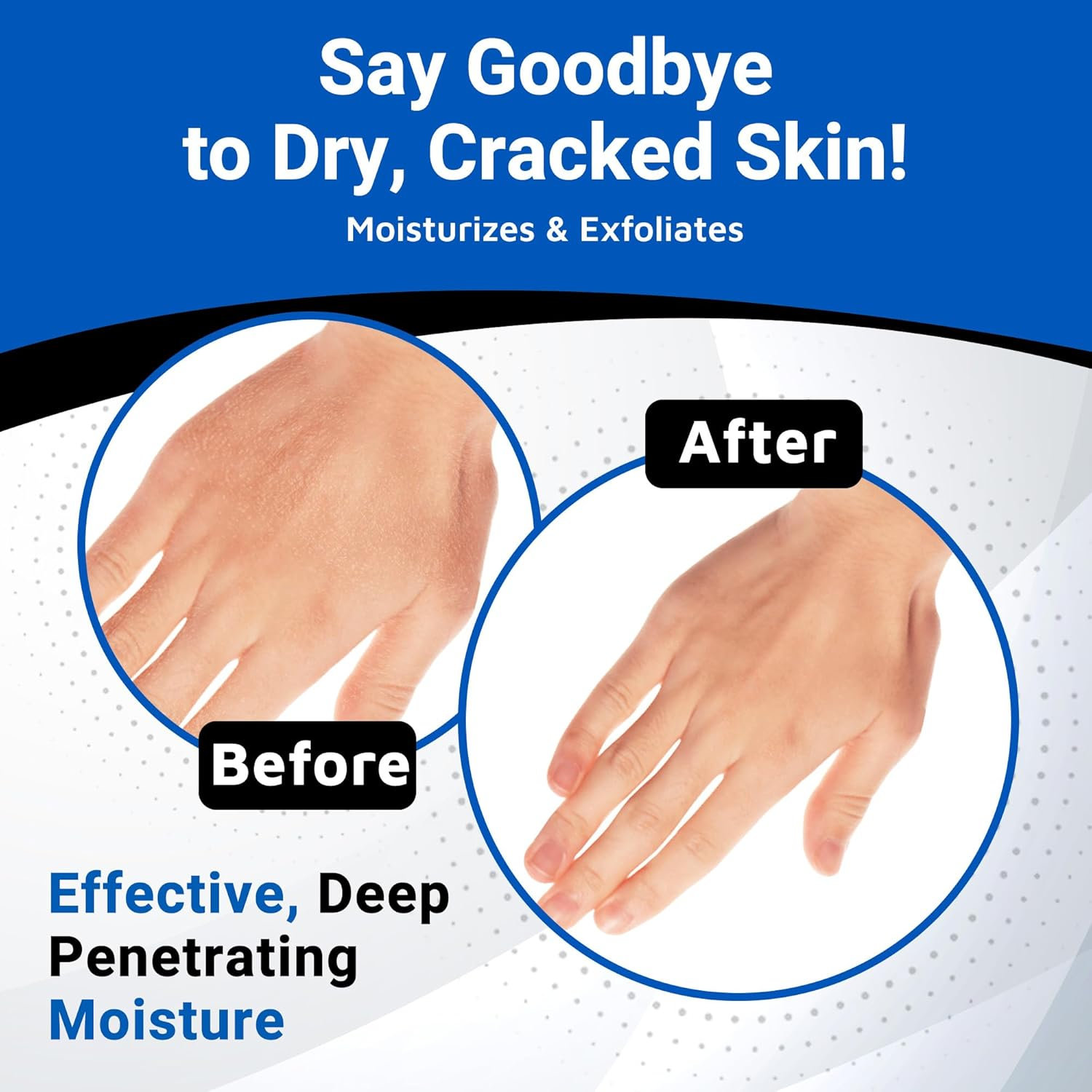 Dermal Therapy Alpha Hydroxy Lotion, 16 Fluid Ounce image number 2