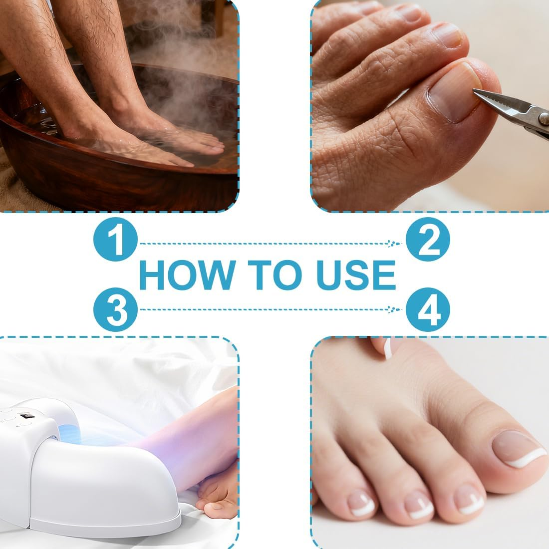 Tomedeks 1 X Nail Fungus Laser with Timer, Nail Fungus Laser Device, Infrared Strongest Effect, Fast Acting