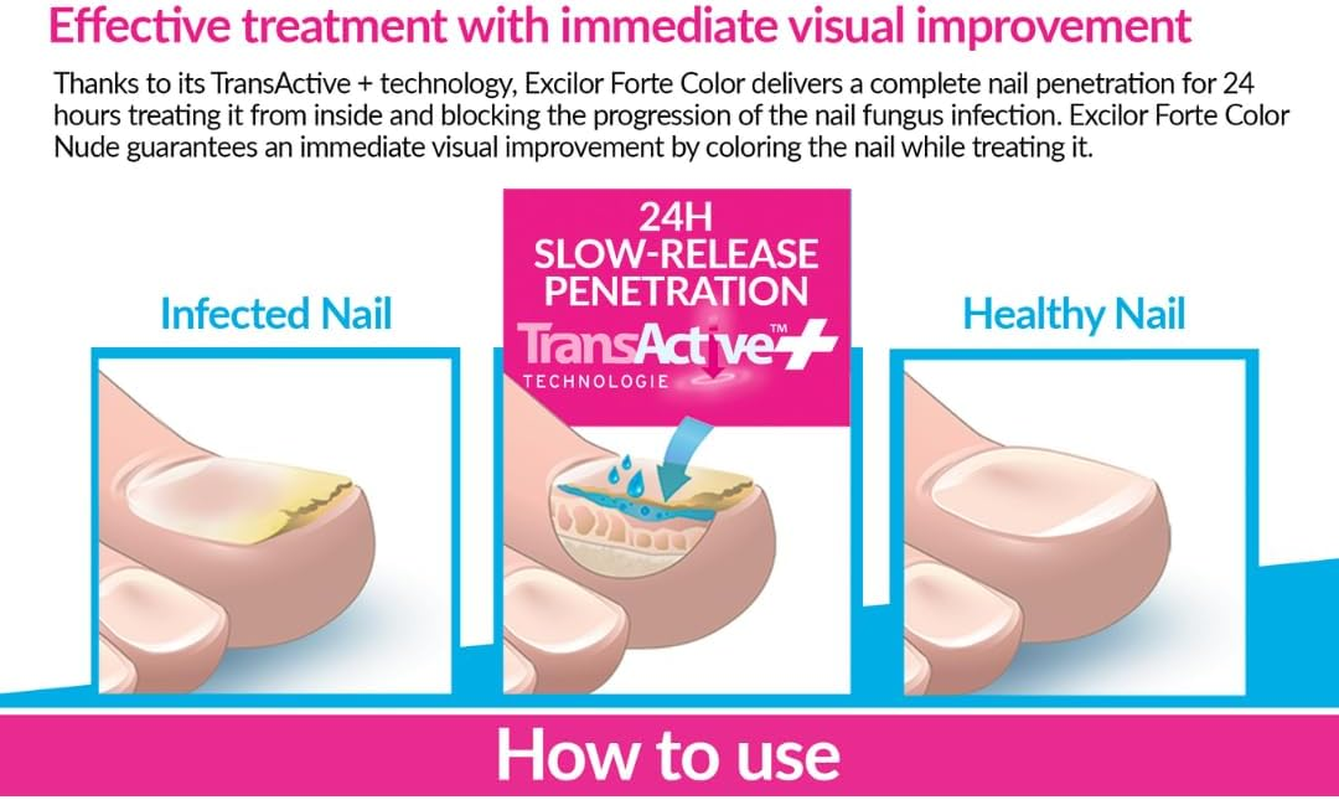 Excilor Ultra Colour - Nude 30Ml. Coloured Nail Fungus Treatment for Infected Nails + a Matching Regular Nail Polish to Match-Up Your Healthy Nails in the Same Colour - Red image number 7