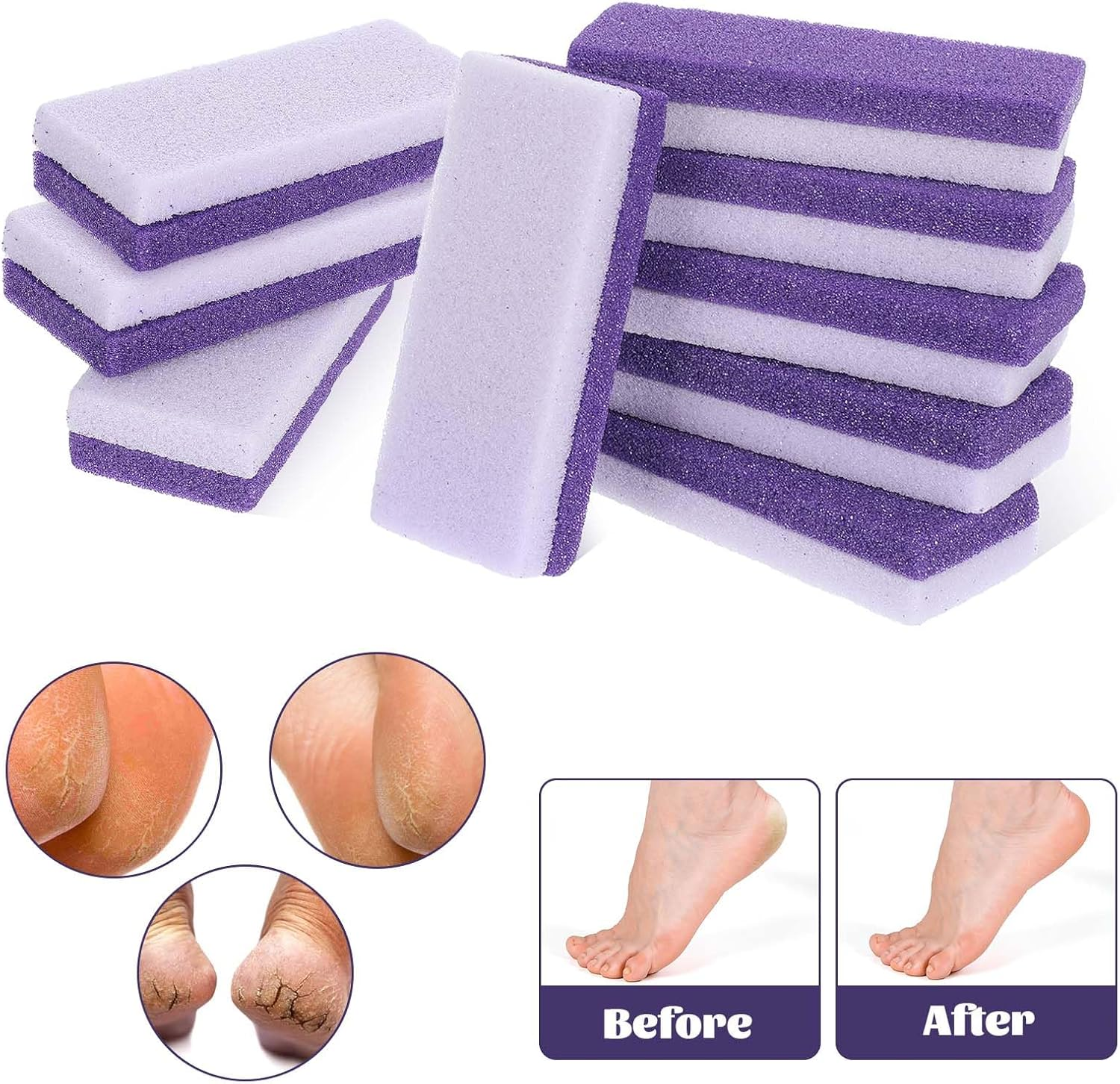 Ptwola Pack of 9 Double-Sided Foot Care Pumice Stone One Side Is a Coarse Callus Remover Foot Pumice Stones the Other Side Softens the Skin for Feet Remove Dead Callus Cuticles image number 3
