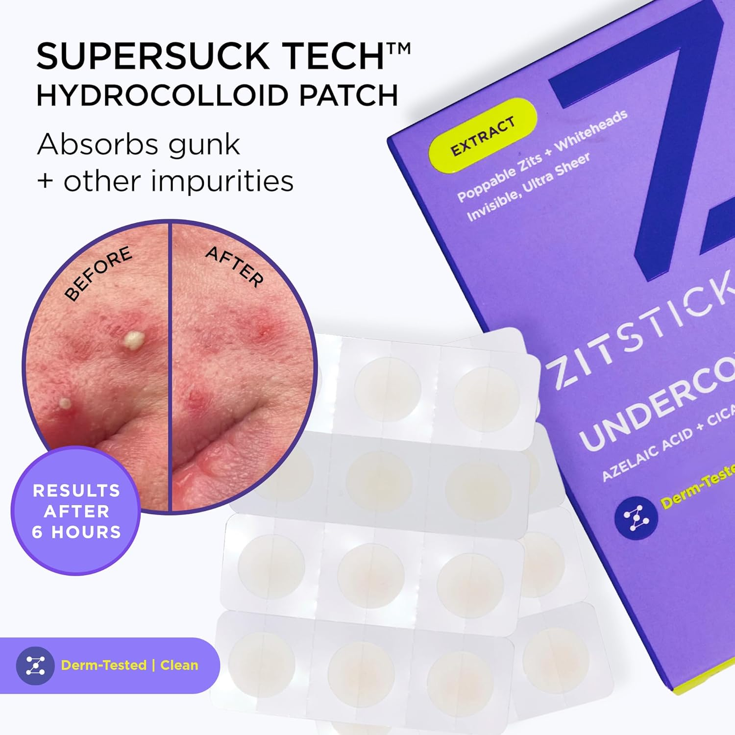 Zitsticka Invisible Pimple Patches for Face, Hydrocolloid Patches, Ultra-Thin Clear Azelaic Acid & CICA Blemish Patches, Pimple Stickers (UNDERCOVER 36 Count) image number 6