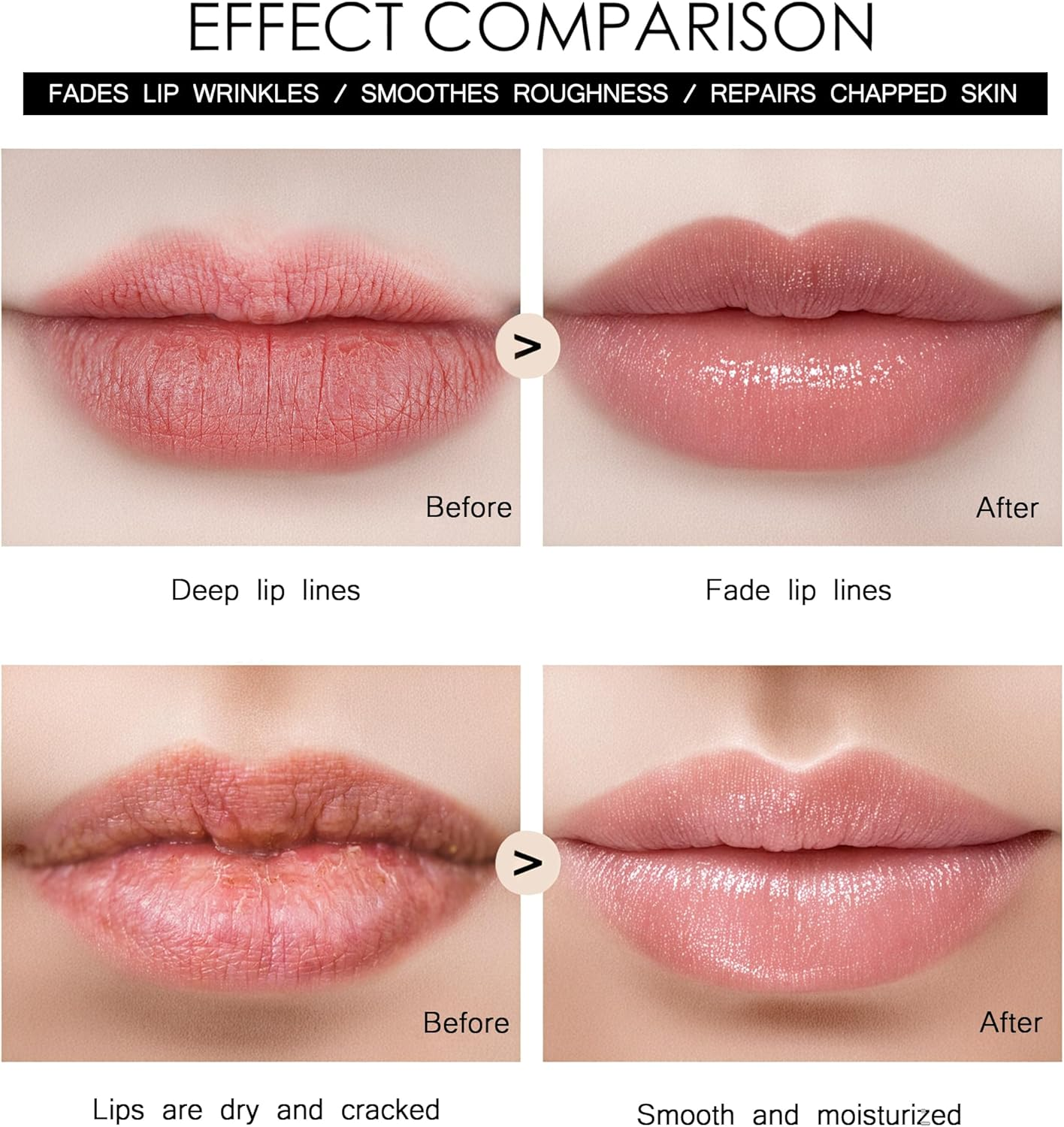 TIDEWISH Derma Roller 0.25 Mm with Liquid Reservoir Derma Roller for Lips, Skin, Scalp Hair Growth and Beard Roller 105 Titanium Needles Skin Care Tools without SERUM image number 5