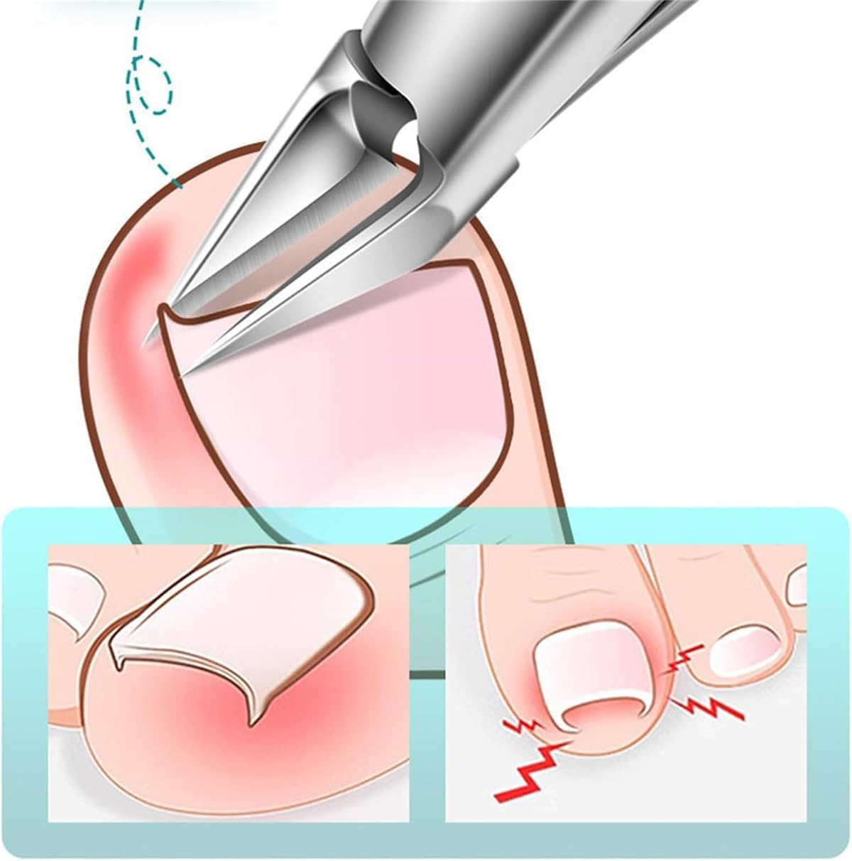 Super Oblique Nail Clippers, Eagle Beak Beveled Nail Clippers, Opening anti Slanted for Thick Nails, Seniors & Ingrown Care (Red) - Blue image number 2