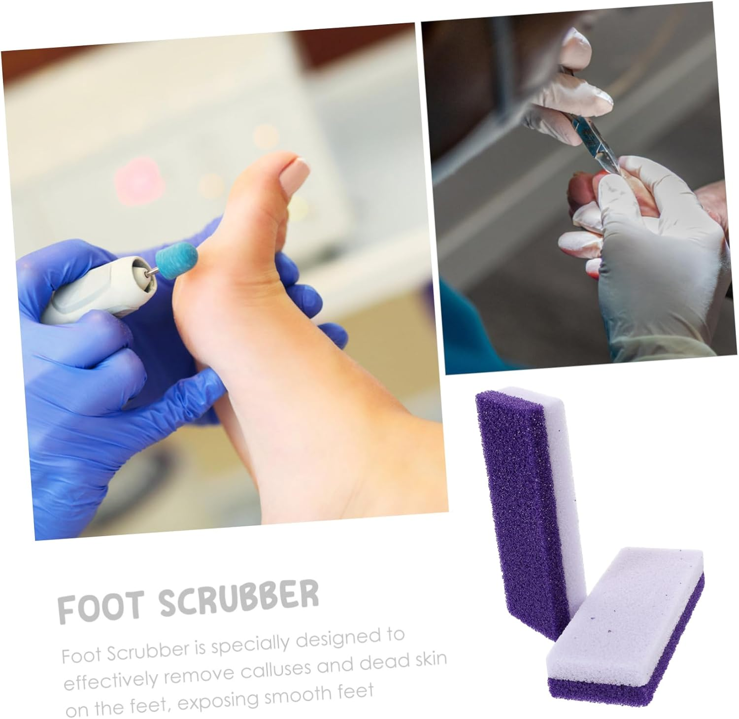 VINTORKY Stone Exfoliating Tool Foot File Callus Removal Foot Dead Skin Scrubber Material image number 5