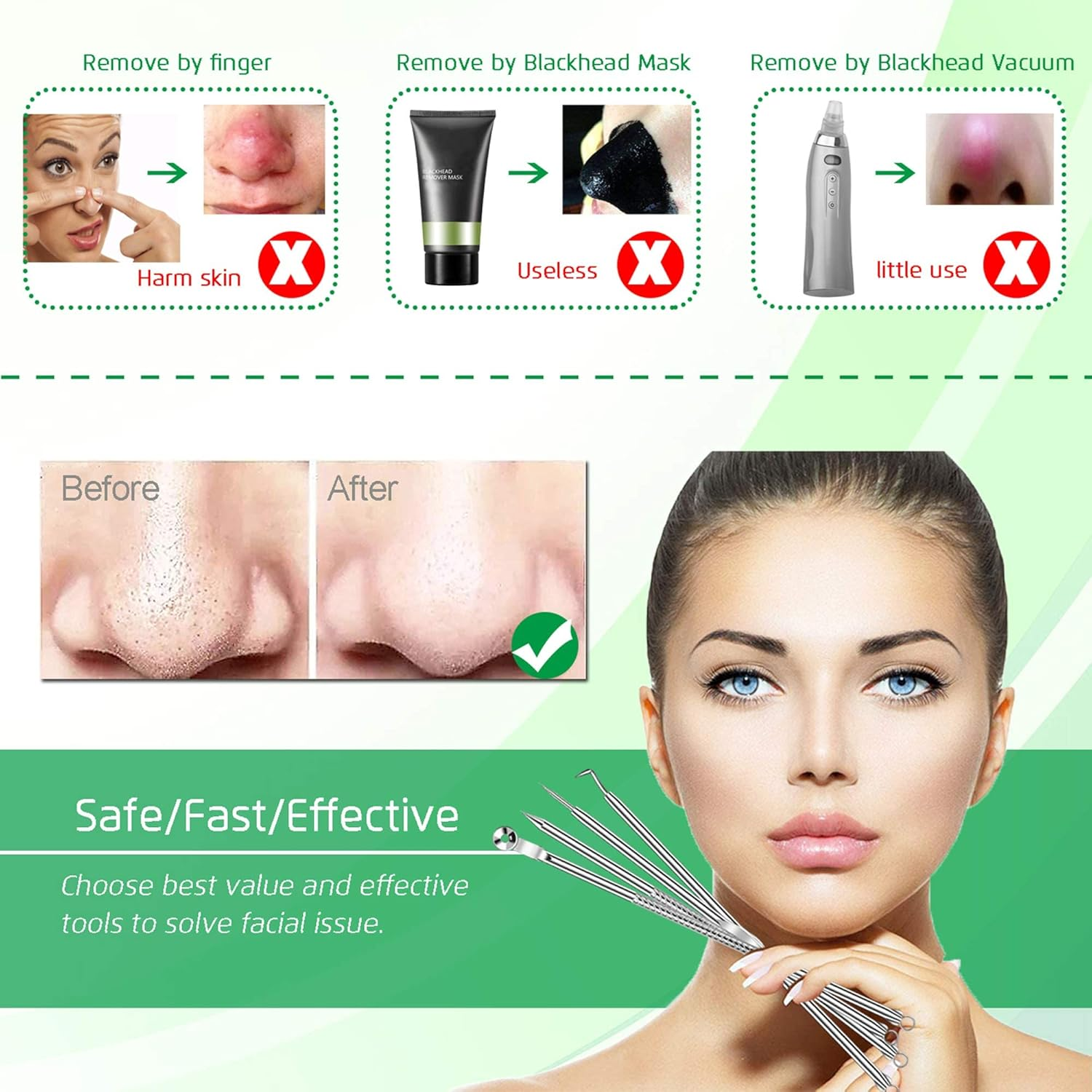 5PCS Blackhead Remover Comedone Extractor, Curved Blackhead Tweezers Kit, Professional Stainless Pimple Acne Blemish Removal Tools Kit image number 2