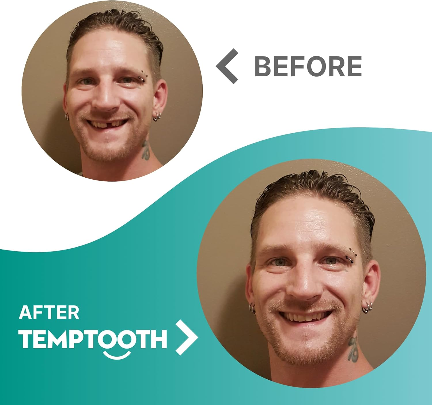 Temptooth Tooth Replacement Product with Coloring Material image number 1