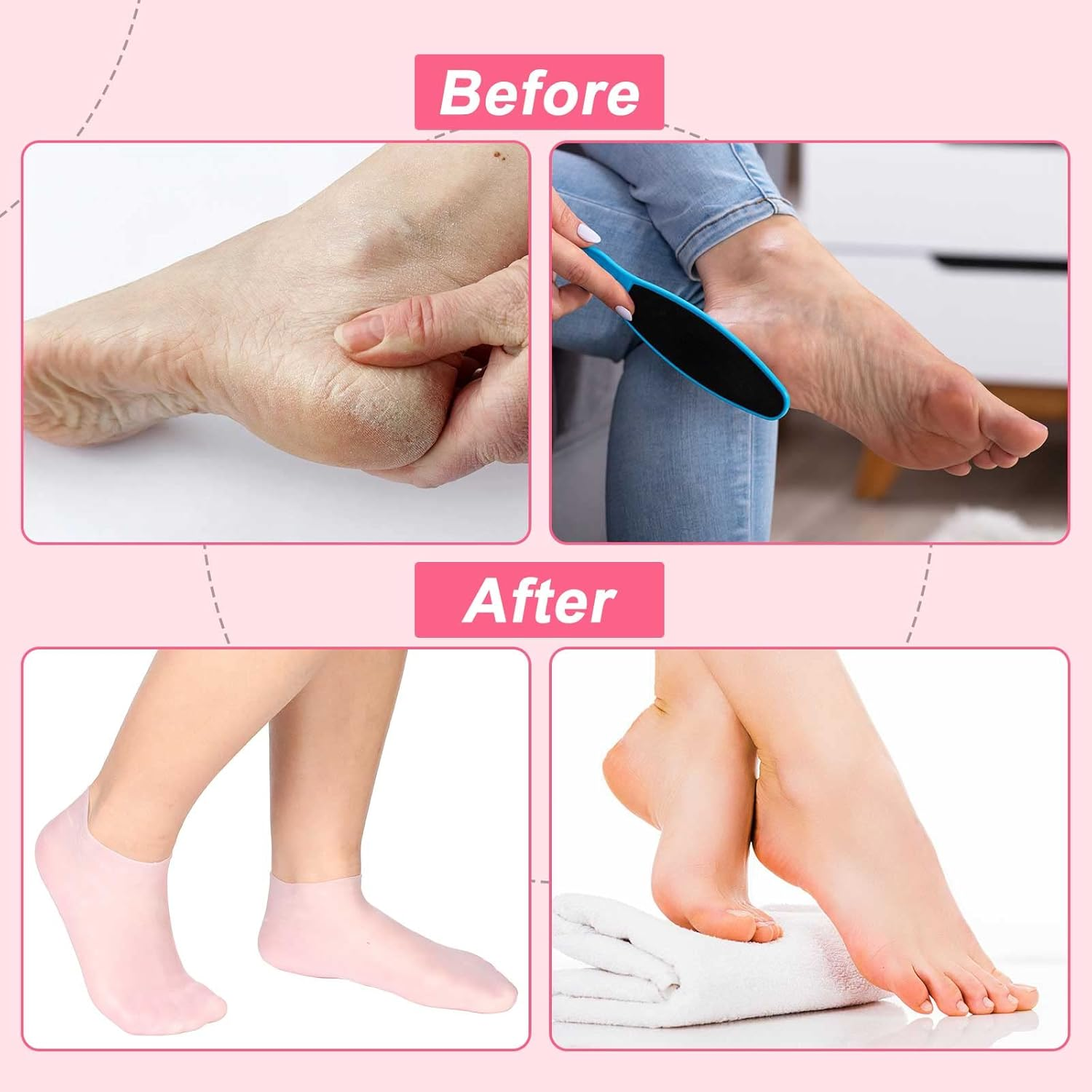 SATINIOR 3 Pairs Silicone Socks for Dry Cracked Feet Women Foot Therapy Spa Pedicure Silicone Sock Repairing Silicones Moisturizing Socks for Softening Rough Skin(Medium) image number 1
