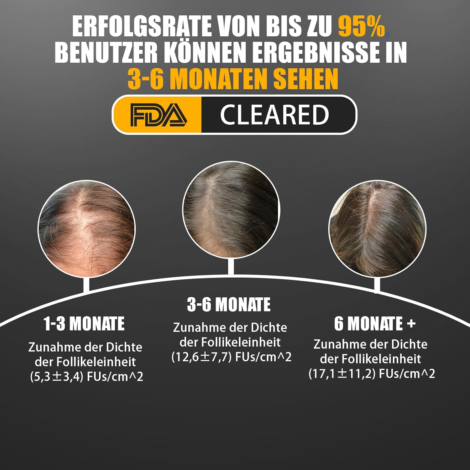 Hair Growth Laser Comb, Medical Grade Laser, FDA Approved Hair Loss Treatment for Men and Women with Thinning Hair, Rechargeable Hair Growth Product (Black) image number 6