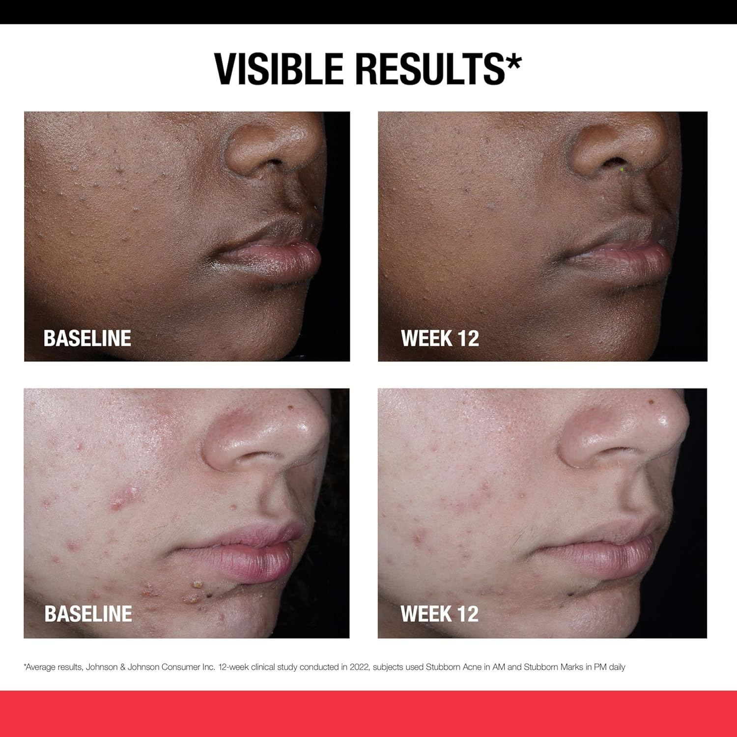 Neutrogena Stubborn Marks PM Treatment with Retinol, Fl Oz image number 2