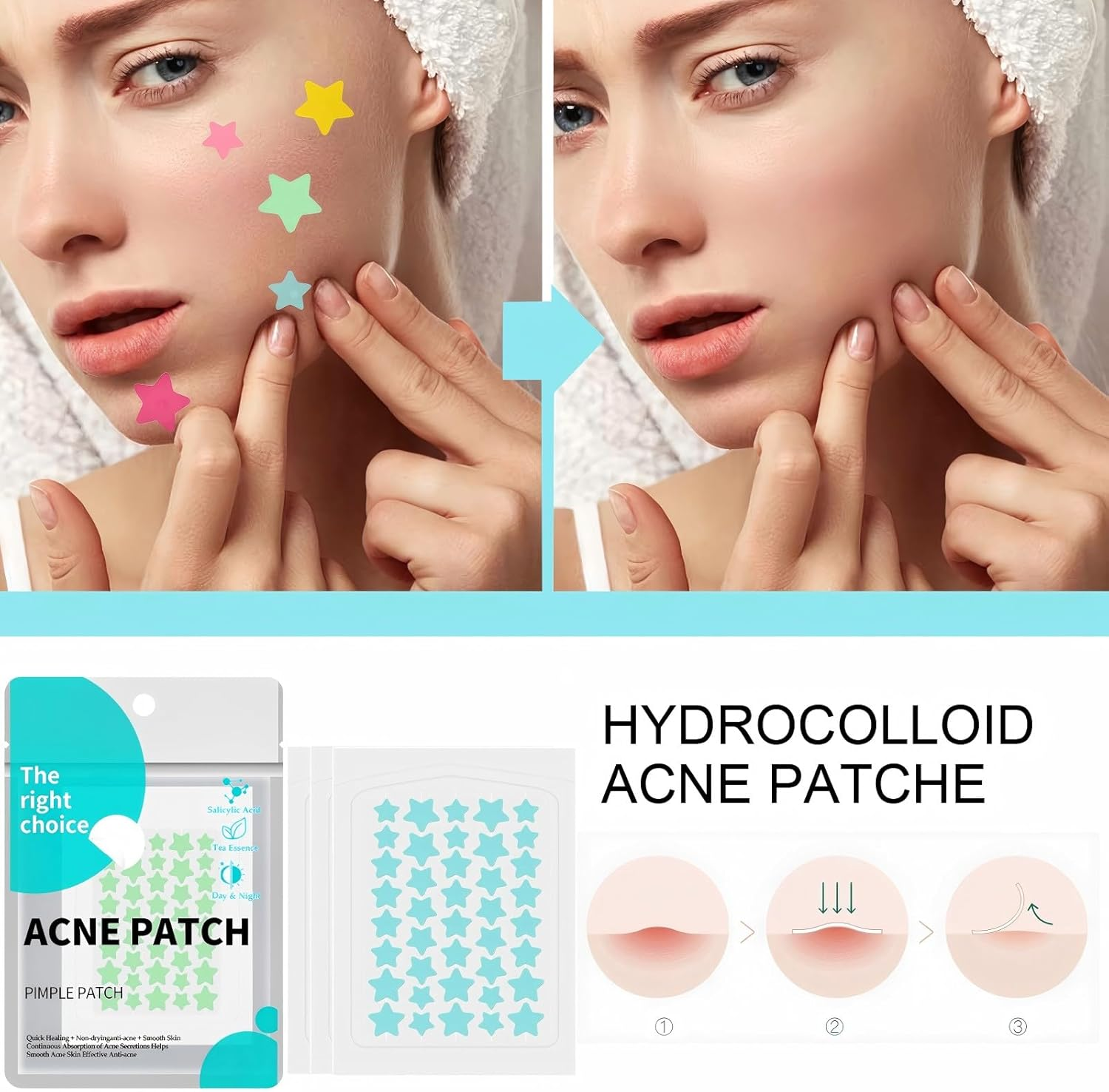 Pimple Patches for Face (400Pcs /10 Sheet), Pink & Blue & Yellow & Green & Rose Acne Patches, Hydrocolloid Patch Acne Dots, Zit Patche for Face Body Skin Clear Spot Treatment Pimple Stickers