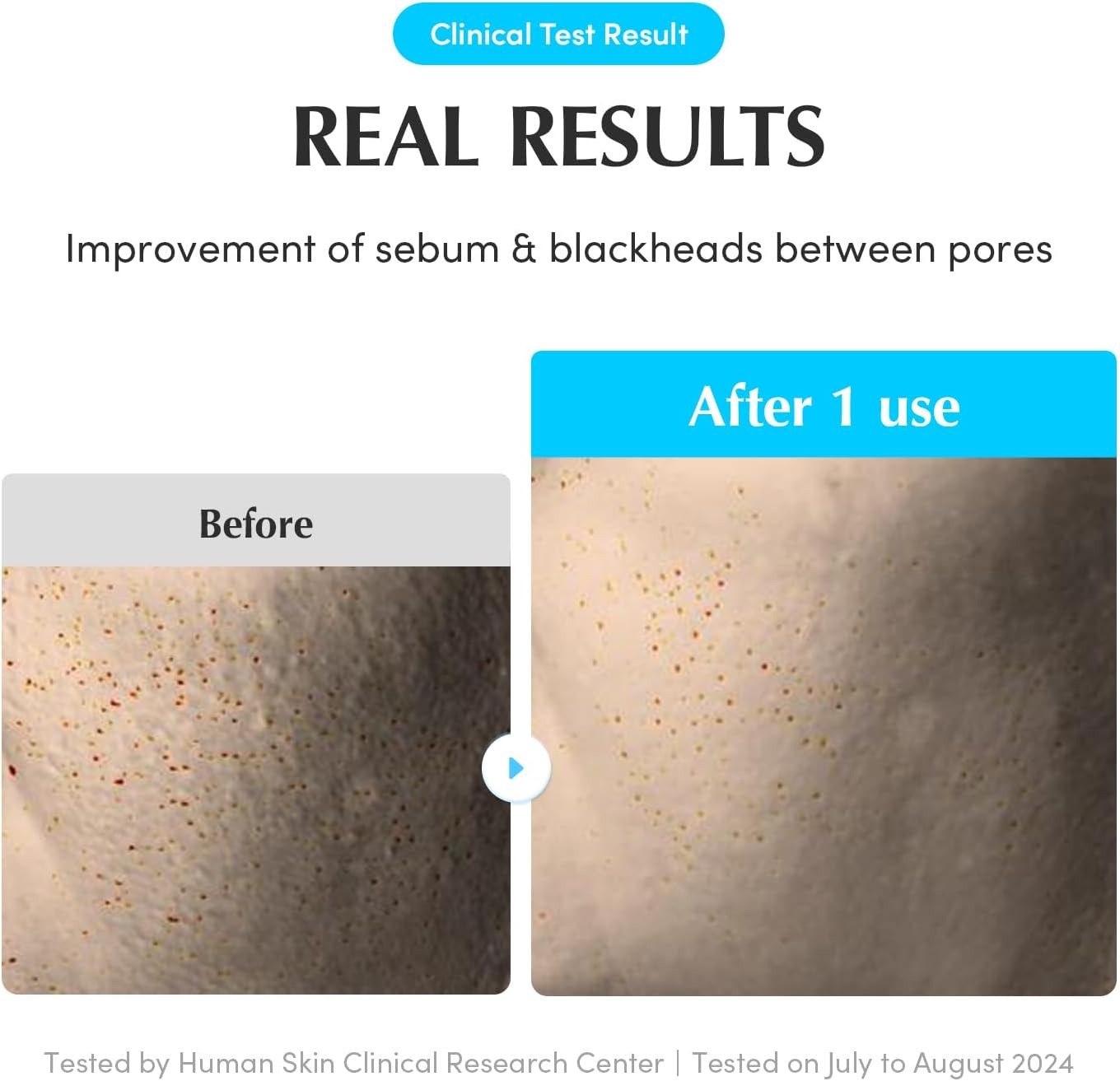 Eqqualberry Swimming Pool Toner Pads image number 1