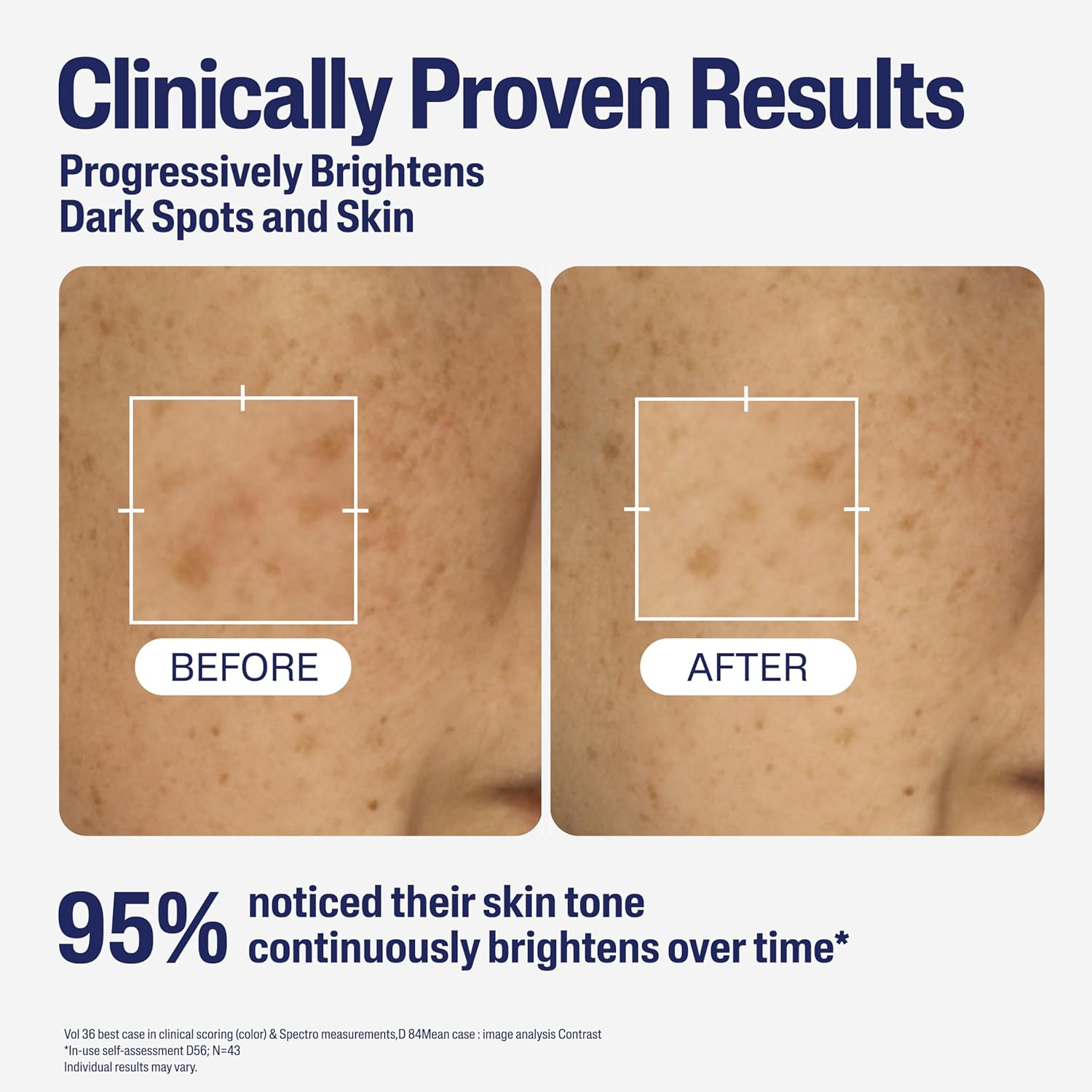 Cetaphil Bright Healthy Radiance Perfecting Serum 30Ml, with Niacinamide, Dermatologist Tested image number 6