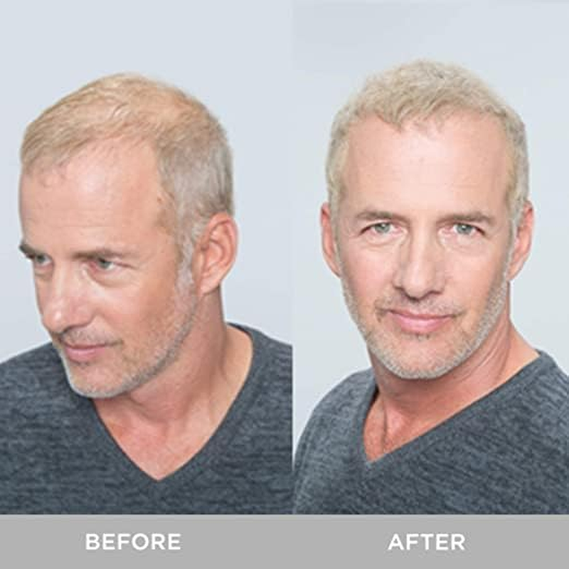 Osking Hair Building Fiber, Concealer Refill Use for Regrowth & All Other Hair Fiber Etc. (Black 25+25+25G) Pack of 3 image number 3