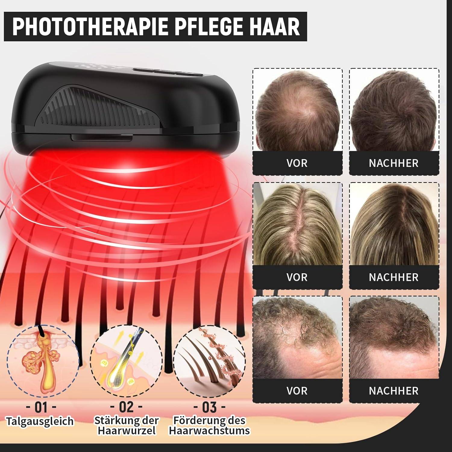 Hair Growth Laser Comb, Medical Grade Laser, FDA Approved Hair Loss Treatment for Men and Women with Thinning Hair, Rechargeable Hair Growth Product (Black)