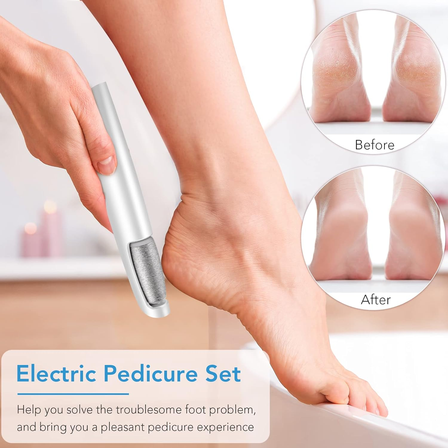 LINKEVAP Electric Callus Remover for Feet, Professional Pedicure Kit Foot Scrubber for Dry, Dead, Cracked, Hard Skin, at Home Feet Spa Care Kit for Men & Women (Cold White) image number 1