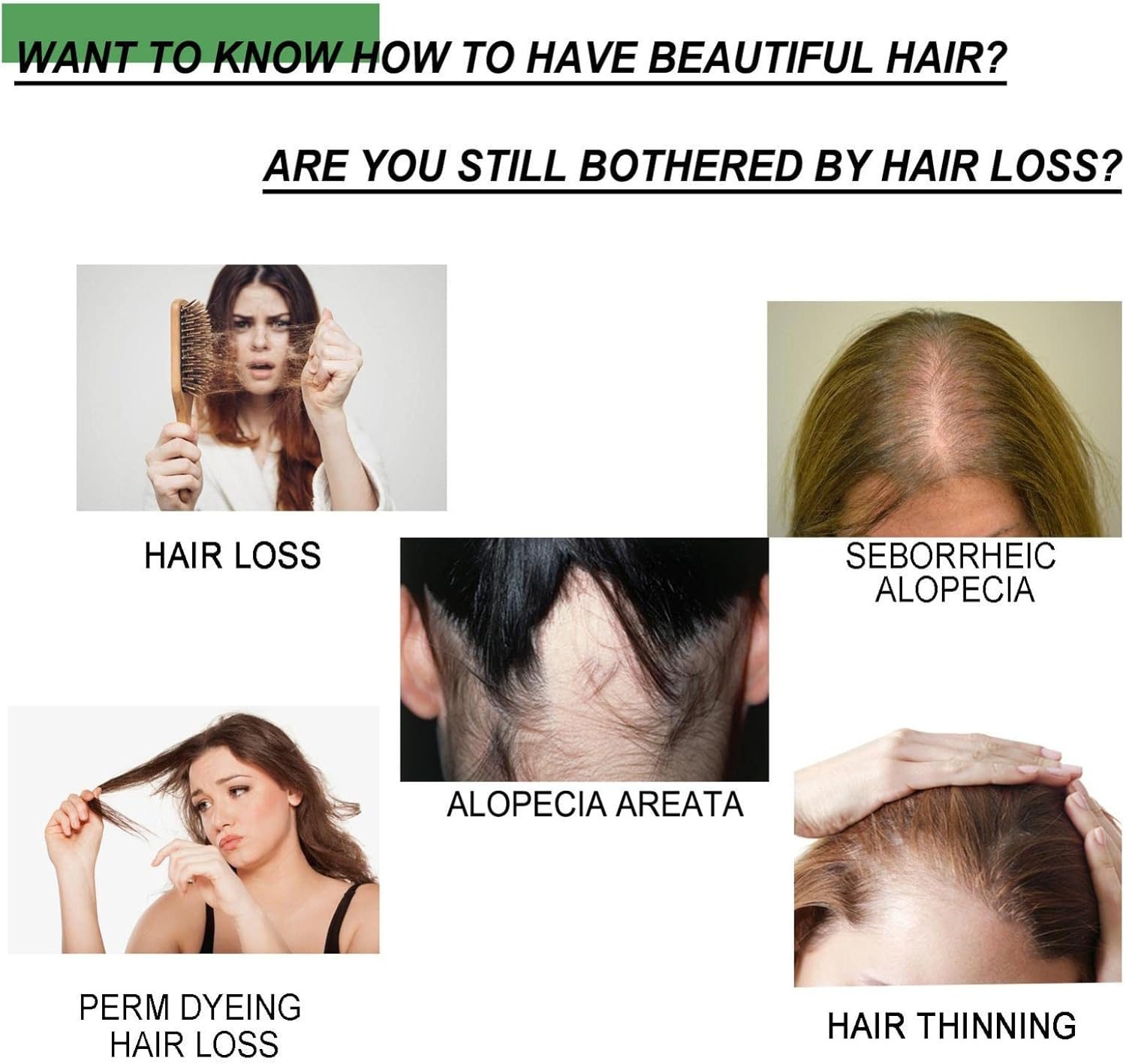 5 Pcs Organic Growth Ginger Spray | Hair Regrowth Spray for Hair Rapid Growth | Safe and Healthy Organic Growth Hair Care Nutrition Spray Dobooo image number 1