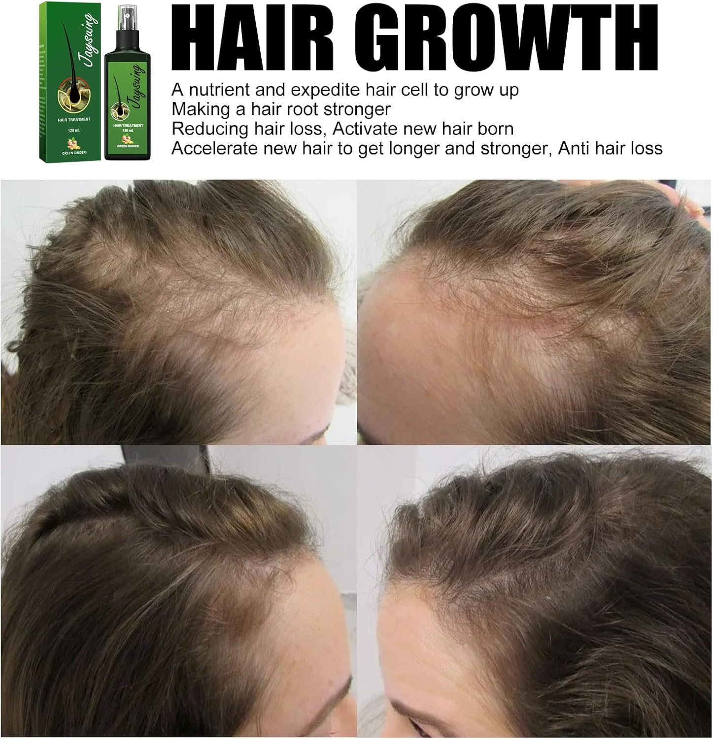 Green Ginger Hair Treatment Spray, 120Ml image number 4