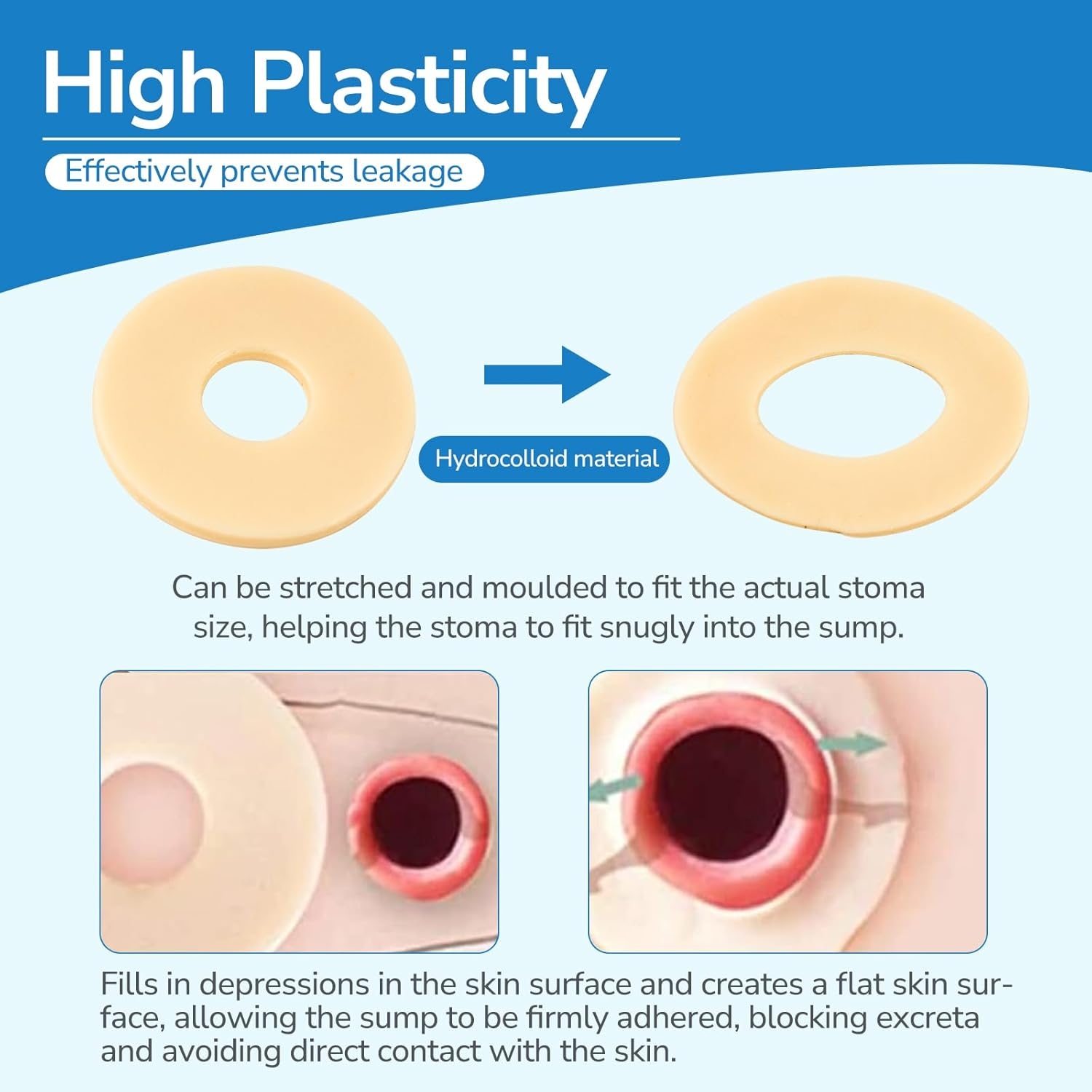 Ostomy Barrier Rings, 10Pcs Ostomy Medical Supplies Barrier Ring Better Seal for Ostomy Bags Compatible with All Bag Types and Brands, Outer Diameter: 4Mm Thickness (Box of 10) image number 3