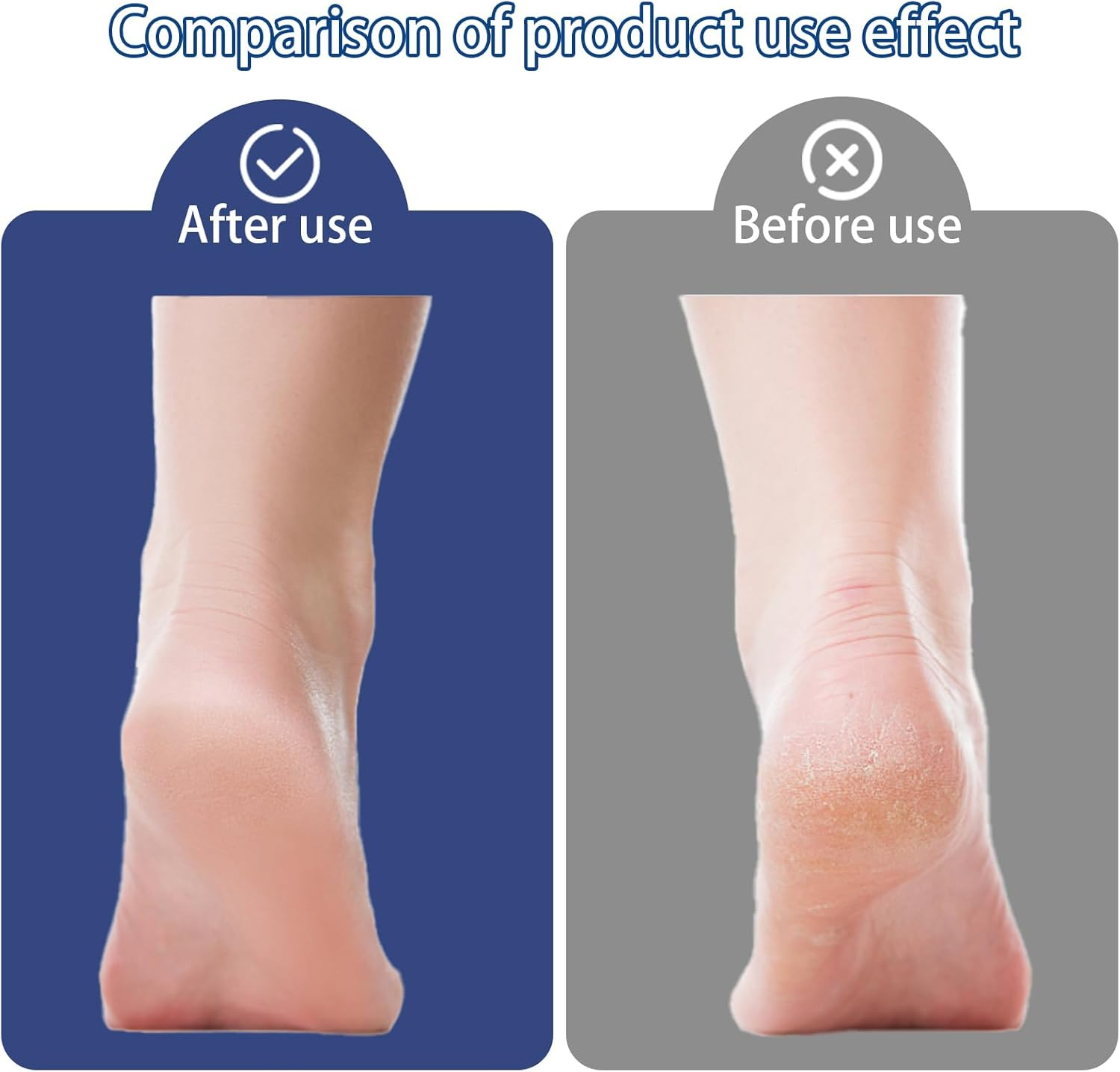 Pack of 3 Pumice Stone Foot Care, Pumice Stone Callus Remover Callus Remover Foot Stone Natural Pumice Stone for Calluses and Skin Hardening Removal image number 2