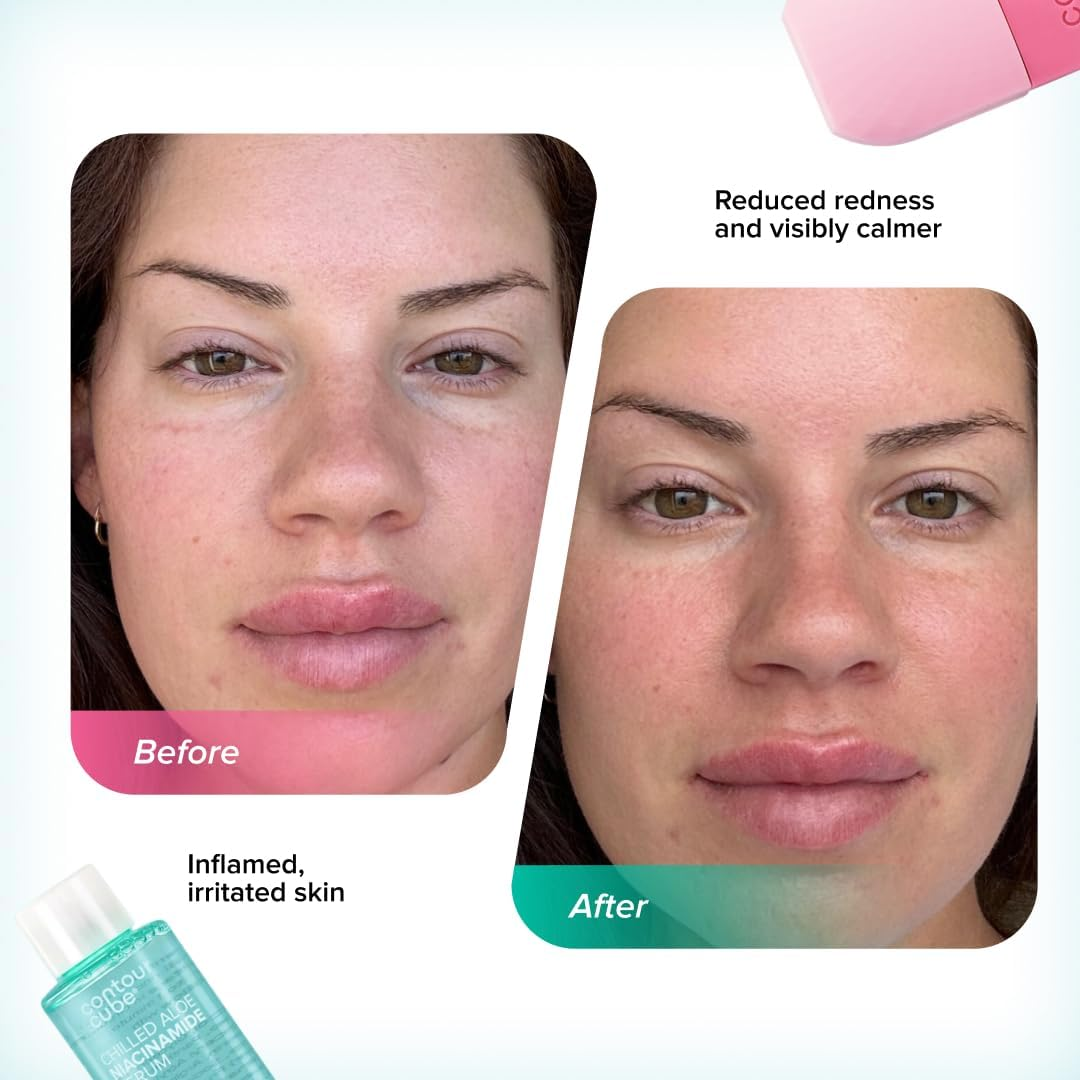 Contour Cube Original - Ice Roller for Sculpting & De-Puffing - Face Ice Roller & Massager with Bpa-Free Silicone - Ice Mold for Face - Skin Care Tools for Daily Skincare (180Ml) - Peach