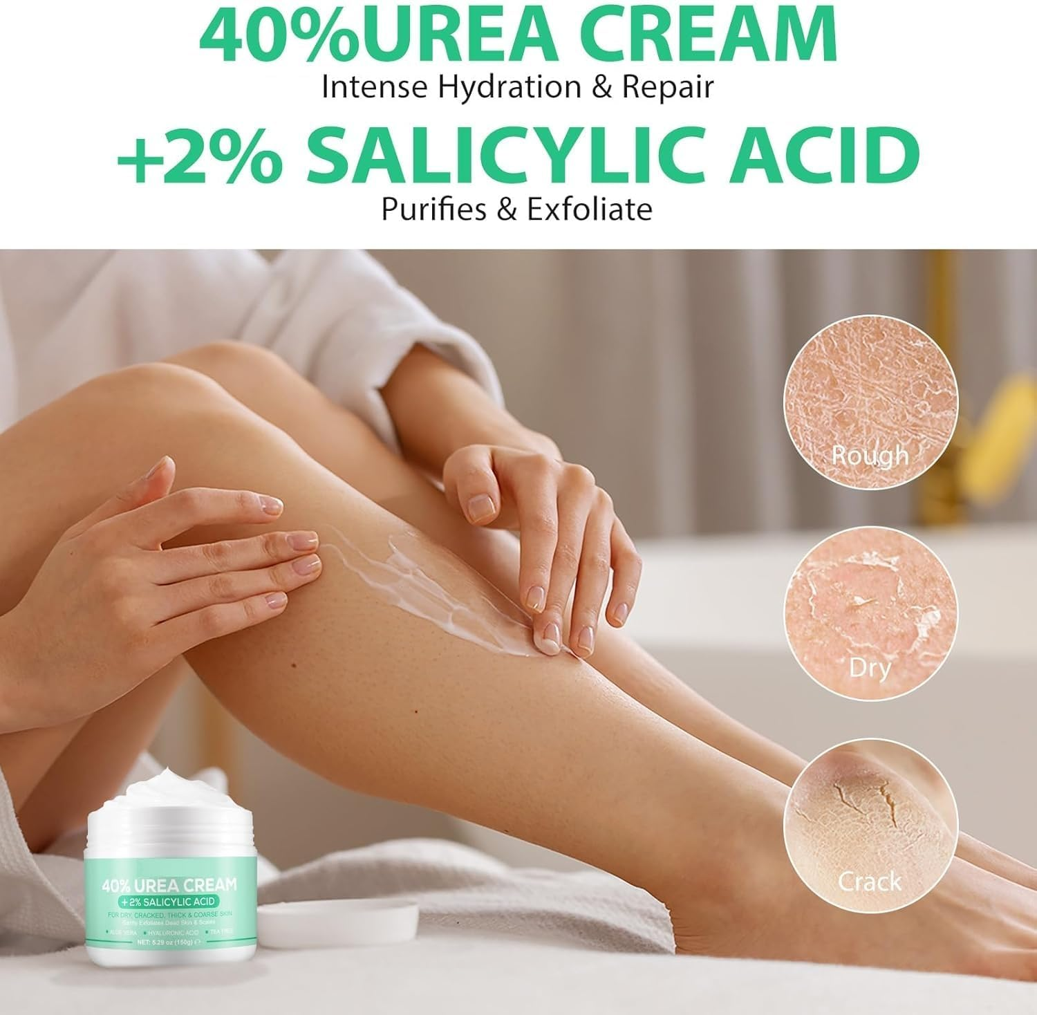 Foot Repair Cream &ndash; Intensive Callus Remover for Dry, Cracked Heels, Hands, Feet, Knees & Elbows | Deep Soften Moisturizer Lotion | Pedicure Exfoliator for Rough, Thick Skin &ndash; 4.6 Oz (130G)