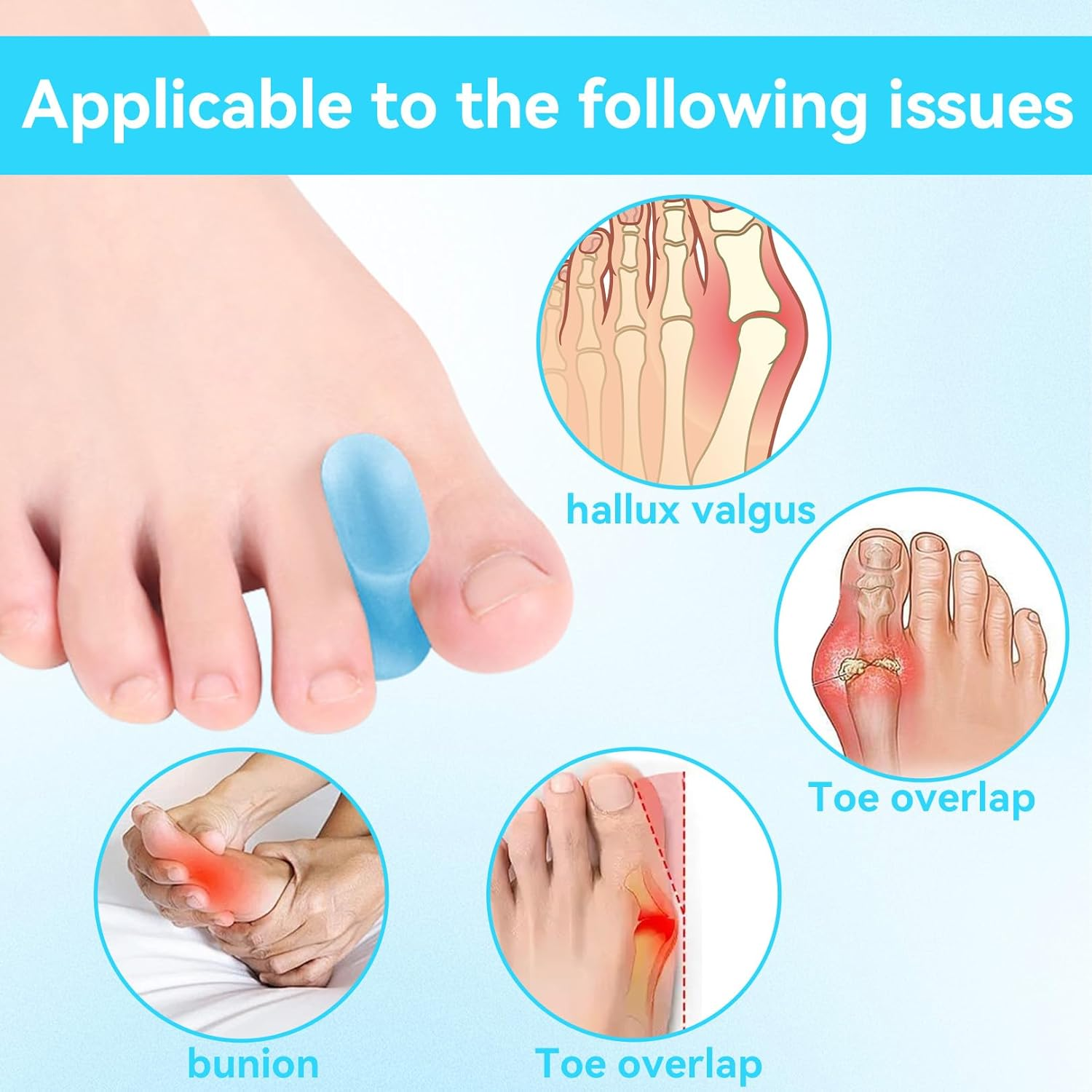 Pack of 8 Gel Toe Separators, Toe Separators, Small Toe, Hallux Valgus Correction, Toe Separator Women'S Silicone, Toe Spacer, Toe Separator, Toe Separator, Large, Toe Separator image number 4