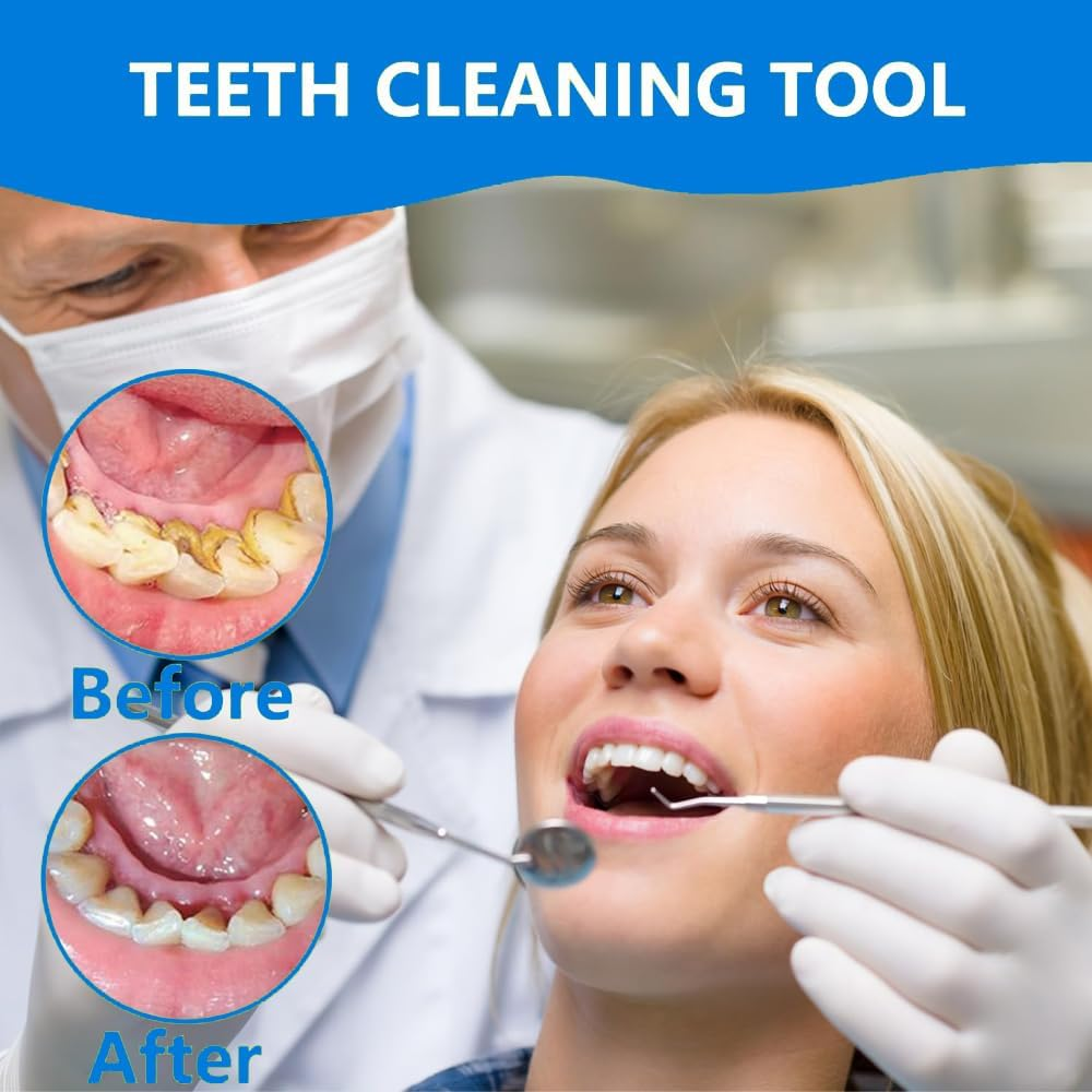 Dental Set Teeth Whitening Hygiene Kit 4Pcs Dentist Tools Set for Home Use Stainless Steel Mouth Mirror Tweezers Dental Picks Oral Care Set to Remover Tartar, Tooth Scraper image number 2