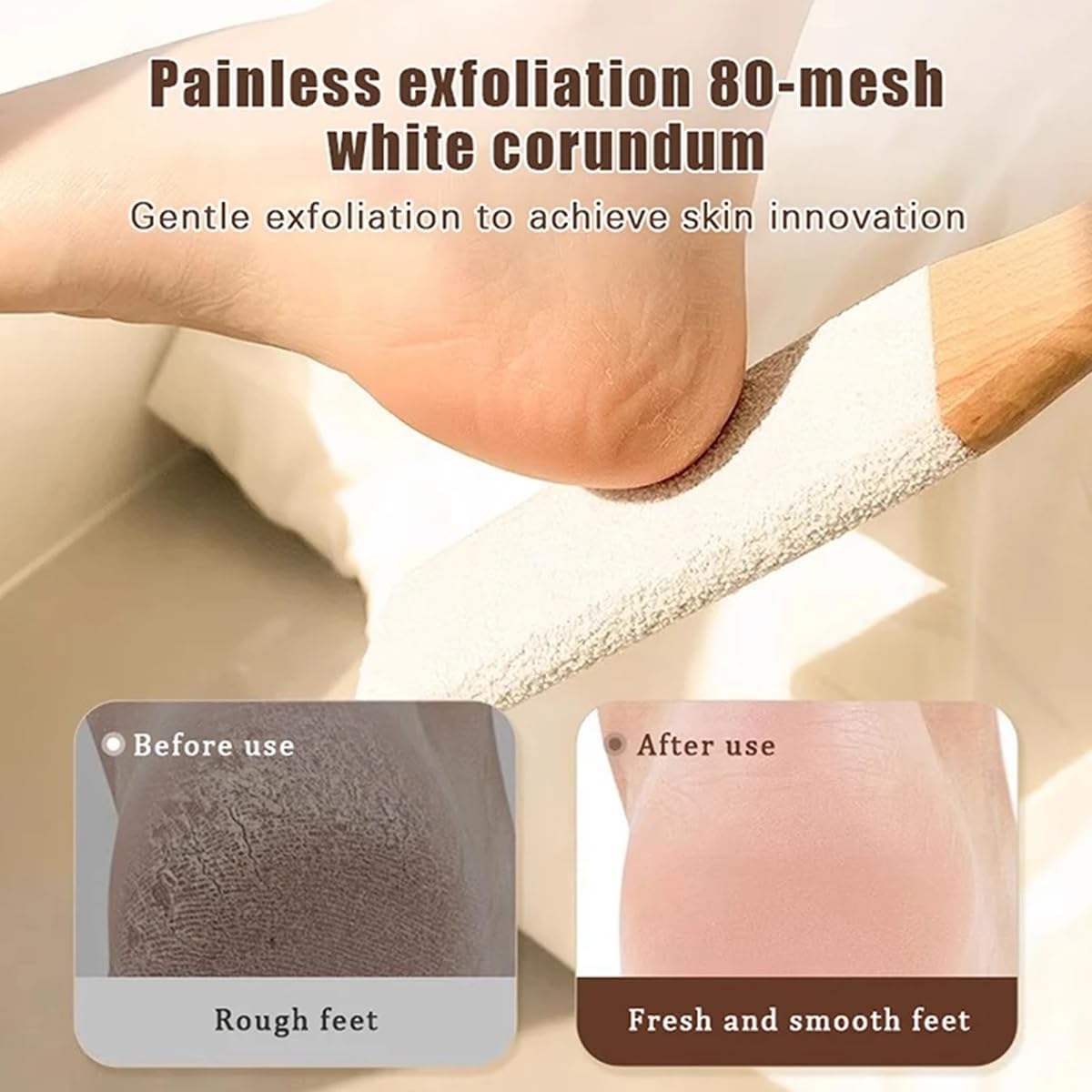 Pumice Stone Foot Care Callus Remover Pumice Stone with Handle for Callus and Skin Hardening Removal Pack of 2