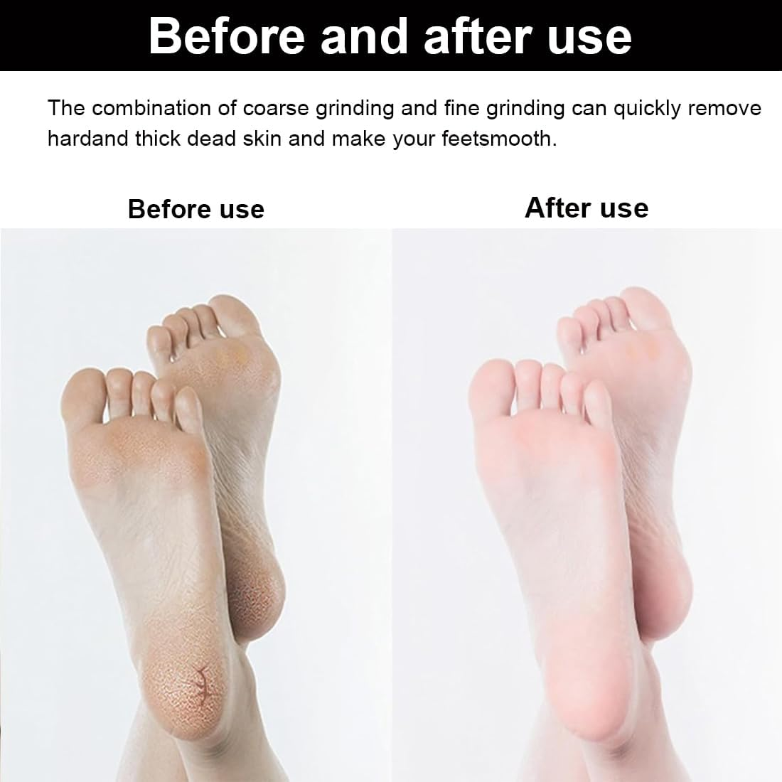 1 Lima Para Pies Durezas Profesional, Pedicura Profesional Para Pies, Quita Durezas Para Pies, Lavable Y Reutilizable, Para Mujeres, Hombres, Sal&oacute;n O Hogar image number 3