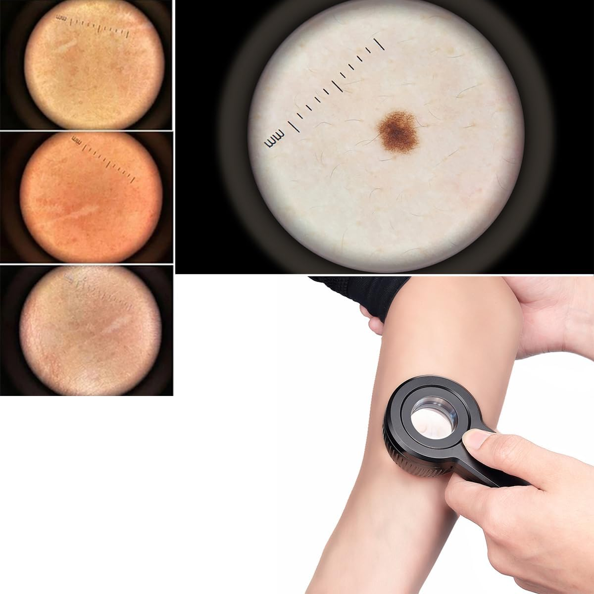 IBOOLO DE-3100 Dermatoscope, 10X Magnify Skin Analyzer Machine Polarized Dermatoscope image number 3