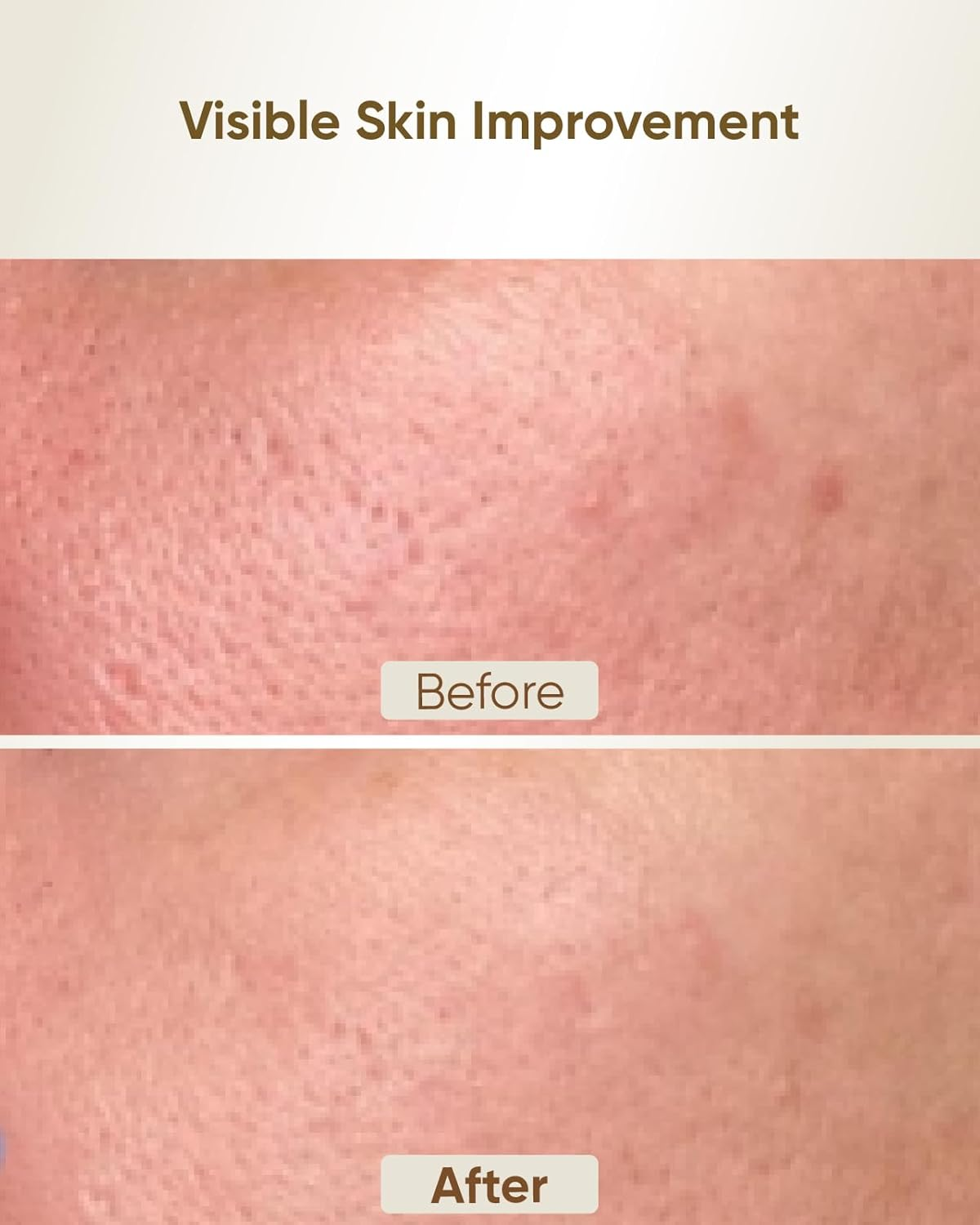 Kingdo 4-In-1 Microdermabrasion Machine Professional-Gentle Exfoliator, Hydrating Mist, Pore Vacuum & LED Mirror-At-Home Spa Beauty Device for Sensitive Skin image number 2