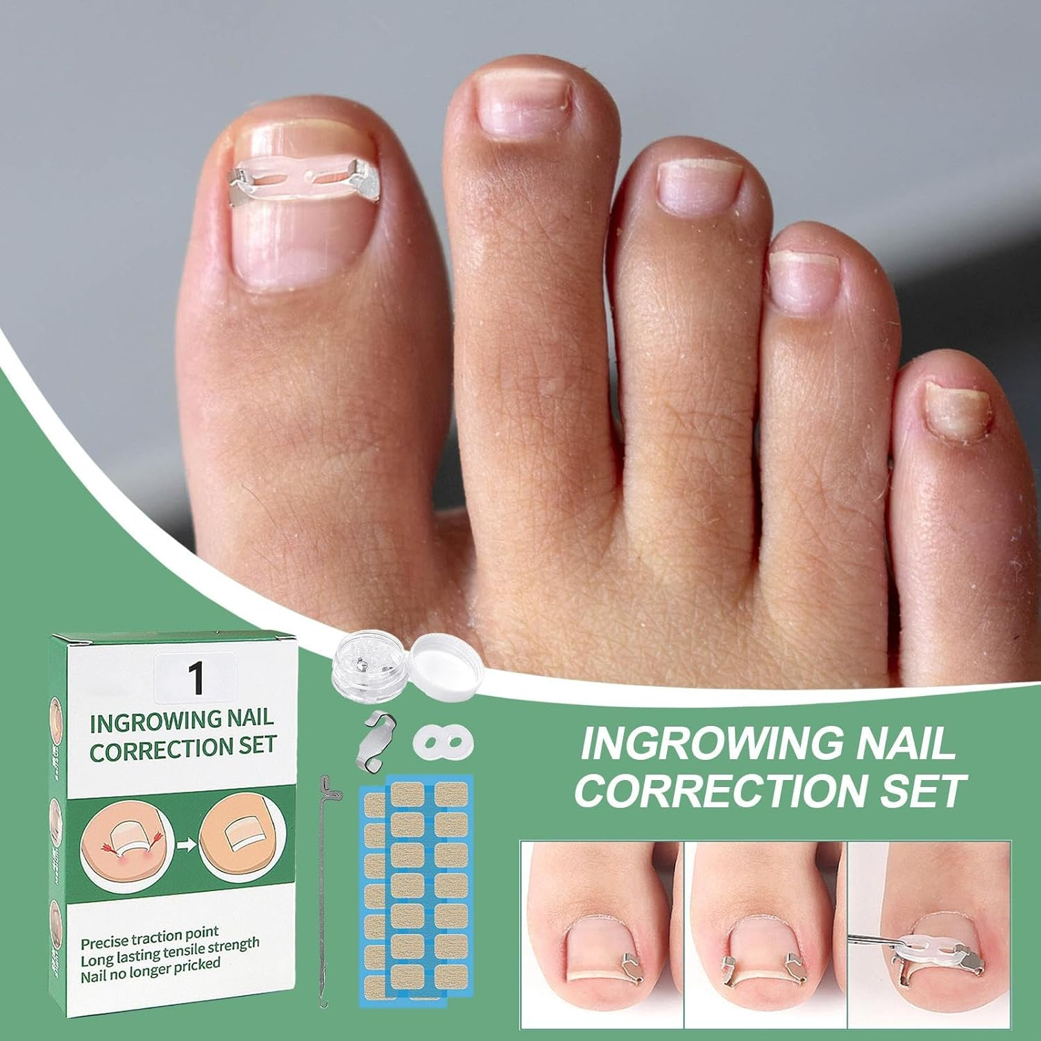 Nail Corrector Patch | Renewal Ingrown Toe Nail Stickers - Breathable Toenail Straightening Tool for Adults Family Friends Foot Care Accessories image number 2