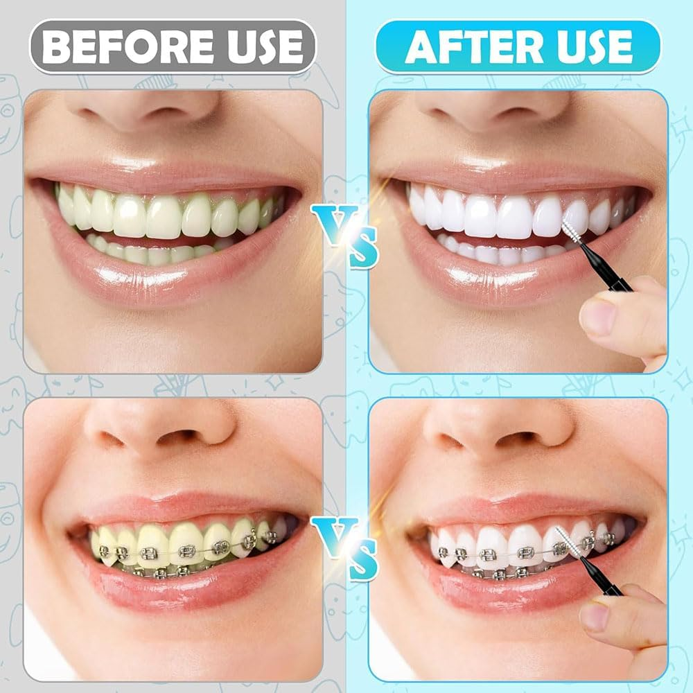 100 Pcs Micro Eyebrow Brush with Cap,Professional Brow Lamination and Eyelash Extension Tools, Dual Ended Spoolie Comb for Lash Filling,Lifting, Black Eyebrow Brushes for Salon and Home Use image number 3