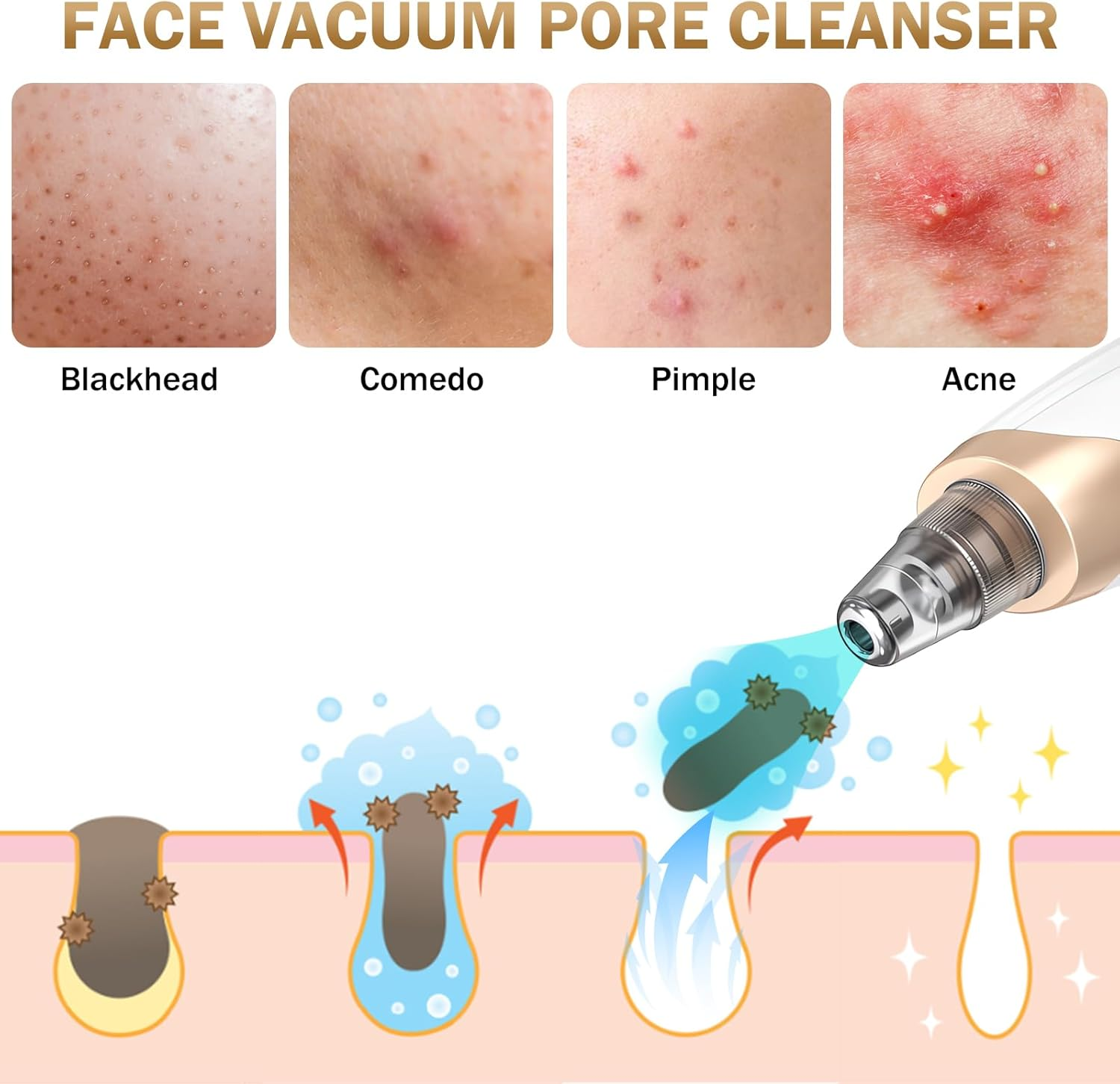 Blackhead Remover Pore Vacuum Kit - 2023 Upgraded Blackhead Extractor Tool with 3 Adjustable Suction Levels, 7 Probes, USB Rechargeable, Suitable for Women and Men image number 5