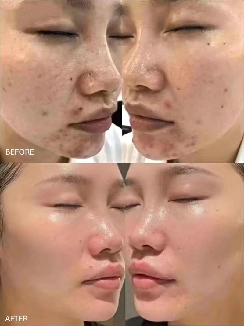 NUNANI - Spicule Treament | Facial Mask Gentle Peel for Blemishes, Texture & Dullness | Hydrating Chlorophyll Formula, Organic Spicules with Antioxidants for Smooth, Glass Skin Glow (5 Treatments) image number 3