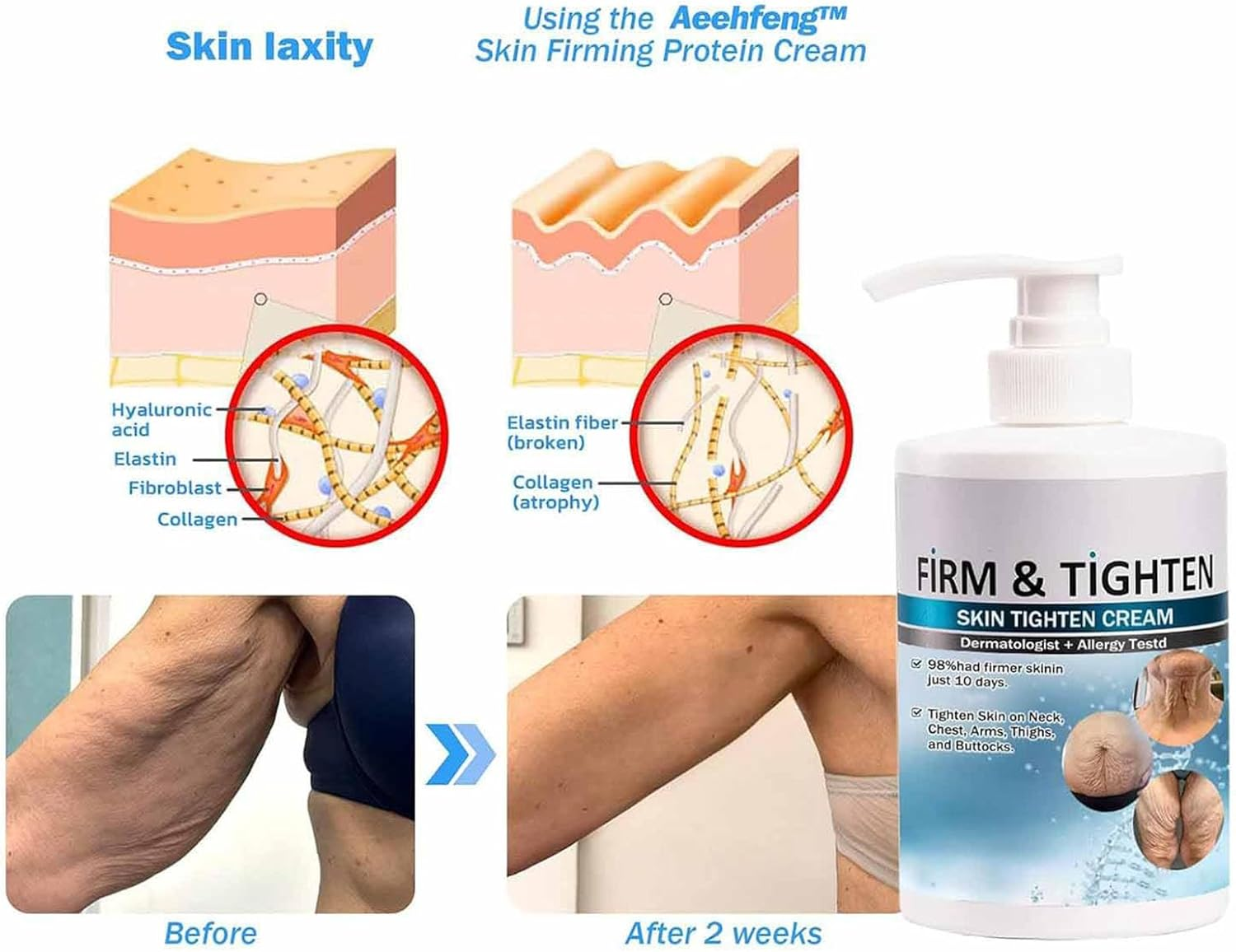 Aeehfengf Firm Tighten Skin Tighten Cream,Firm and Tighten Skin Cream,Aeehfengf Skin Firming Cream,Skin Tightening Cream,Anti-Aging Neck Cream,Skin Firming Protein Cream,Elastin Moisturizer (2Pcs) - 1Pc image number 7