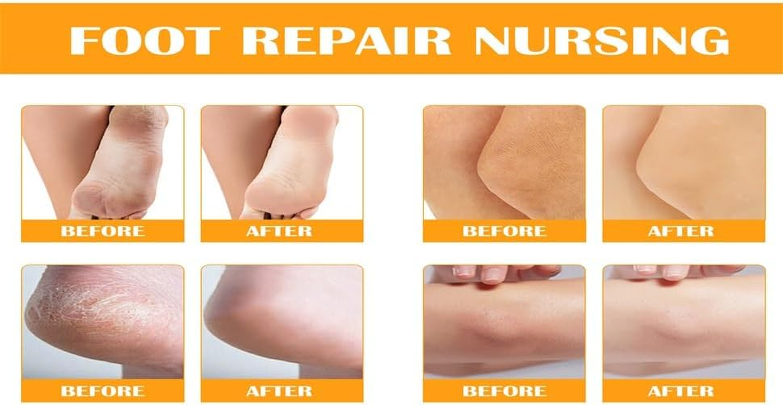 Foot Peeling Spray Oil ，Foot Exfoliating Spray, Pedicure Dead Skin Exfoliator for Cracked Rough Heels, Dry Toe Skin & Calluses, Quicky Remove Dead Skin (Orange) image number 3