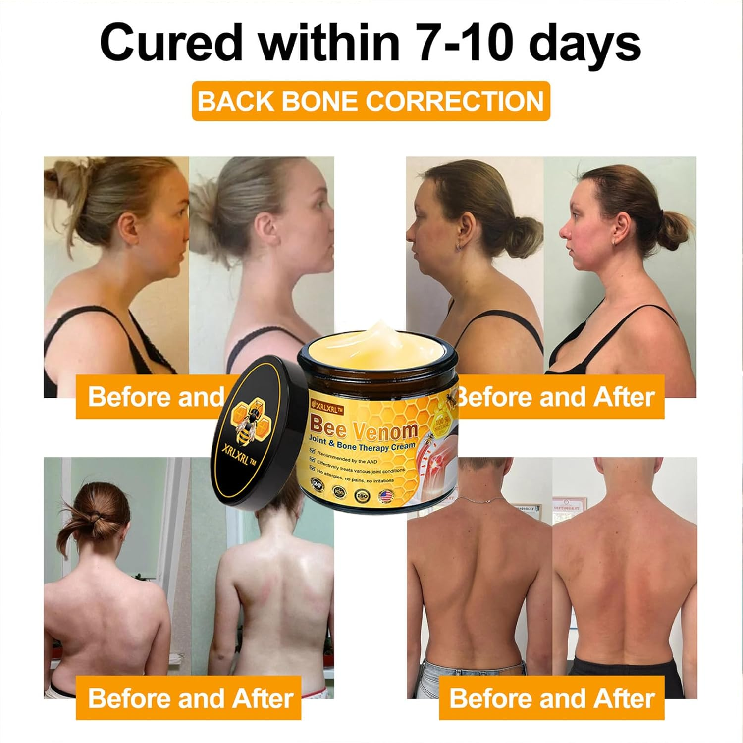 XRLXRL Bee Venom Joint and Bone Cream,Xrlxrl Bee Venom Cream,Improve Joint Mobility, Fast-Acting (4) image number 6
