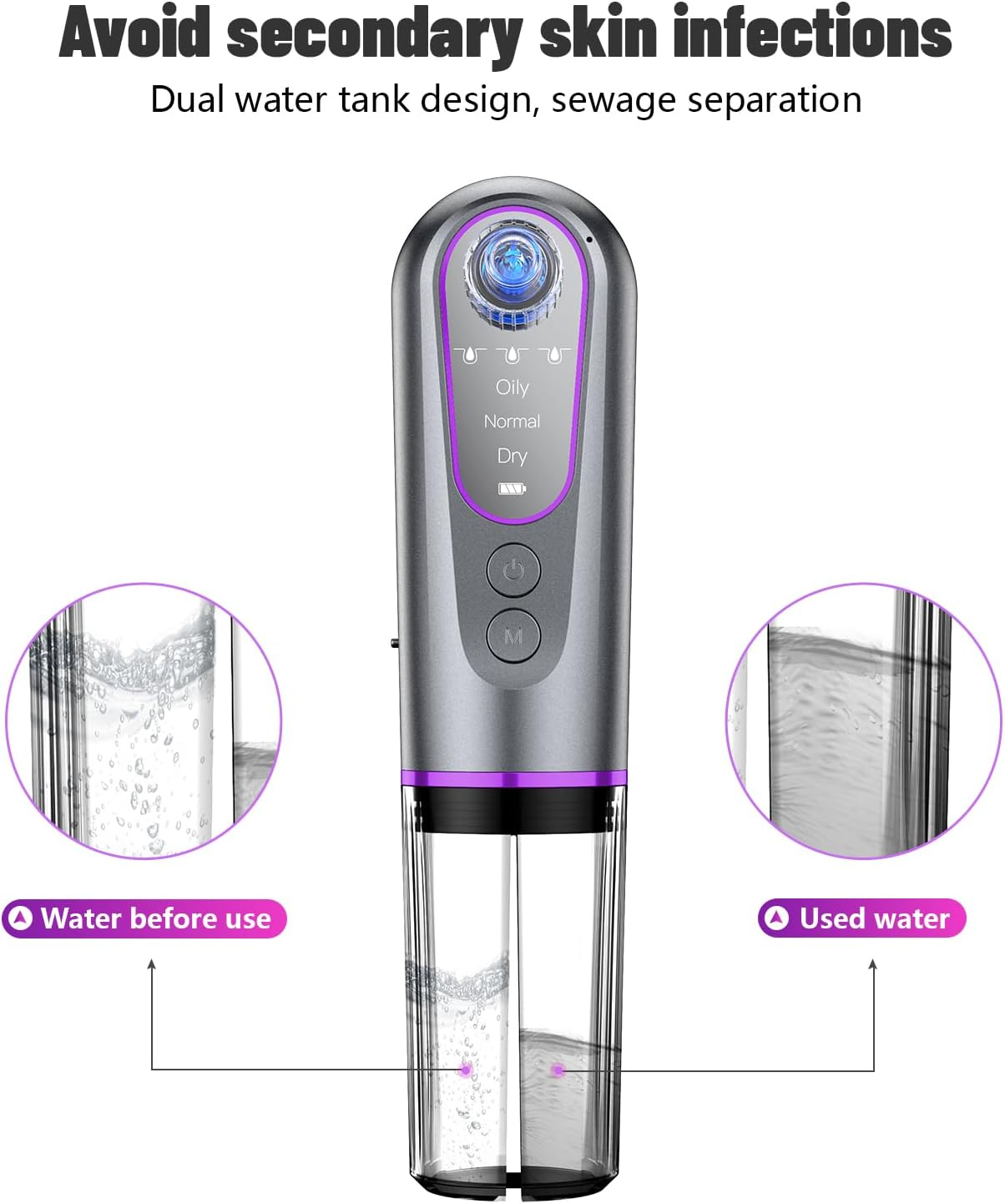 Blackhead Remover, Pore Cleaner, Euakee Vacuum Suction, Blackhead Suction, Pore Cleaner, 5 Suction Heads, 3 Modes, USB Charging Facial Cleaning, Picke Vacuum, Acne Remover, Device Blackhead Remover image number 1