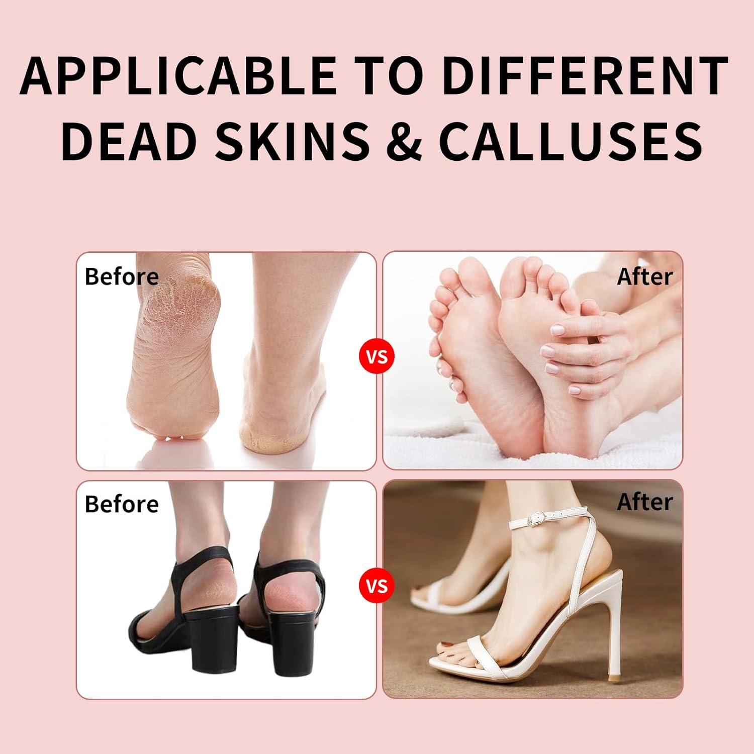 2025 Dermave Electric Foot Callus Remover for Feet, Professionalpedicure Tool Fordead Skin Removat, Best Electrie-Foot File for Women with 60 Sandpaper Discs for Soft Smooth Feet image number 1