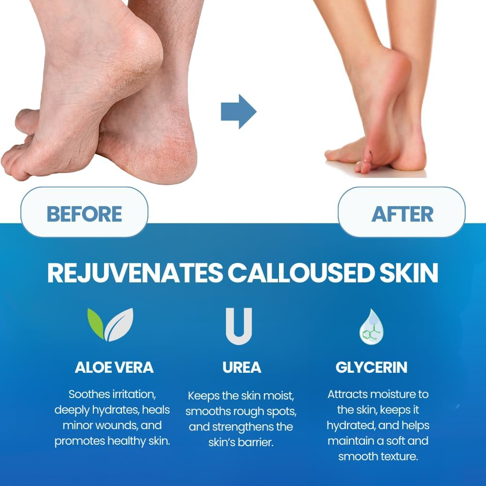 Callus Remover for Feet Extra Strength with Stainless Steel Foot File (Pedicure Grade) - Professional Foot Rasp Callus Remover Softener - Callus Care Heels, and Hands - Cuticle Remover & Softener image number 6